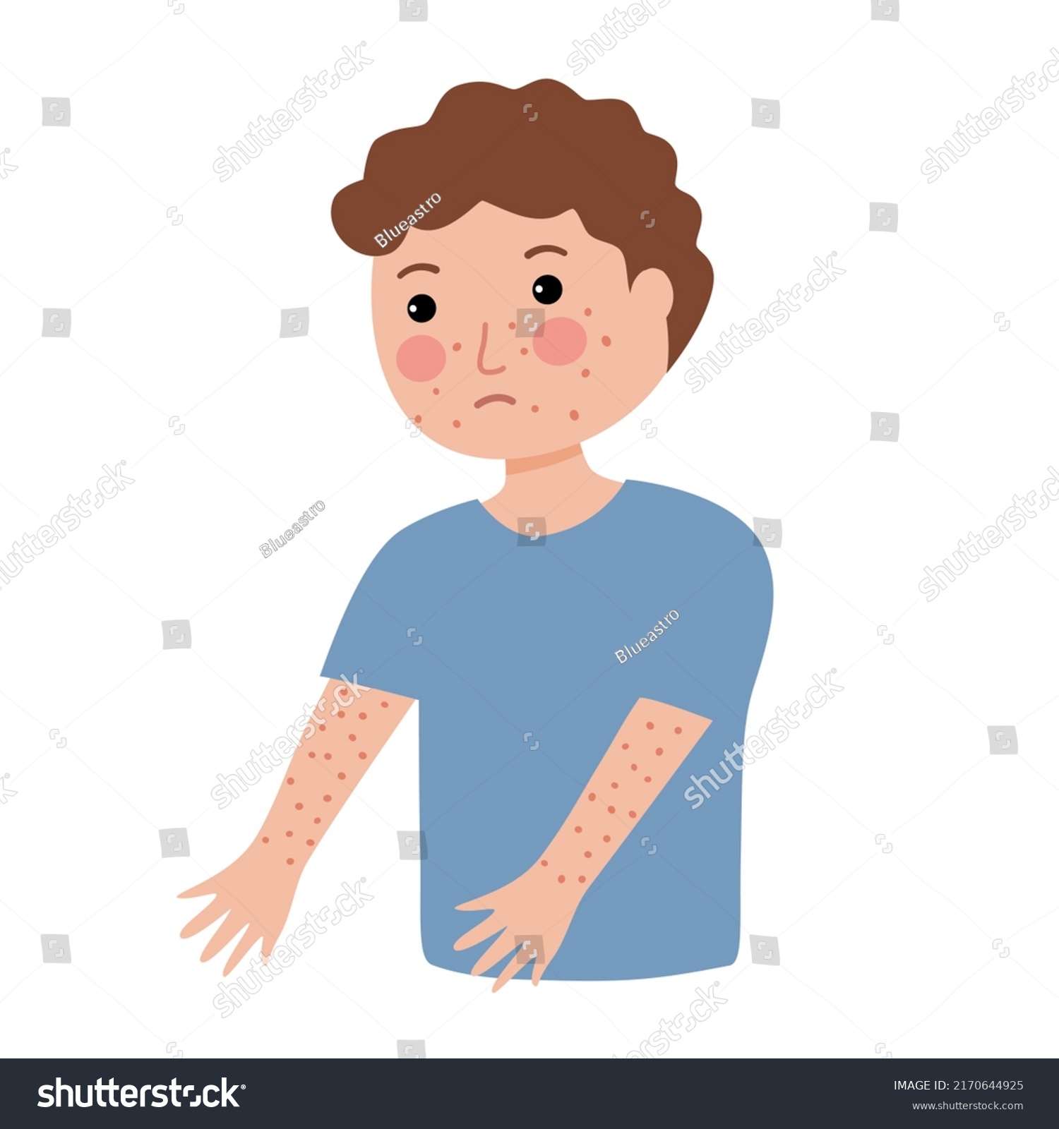 Boy Rash On Skin Flat Design Stock Vector (Royalty Free) 2170644925 ...