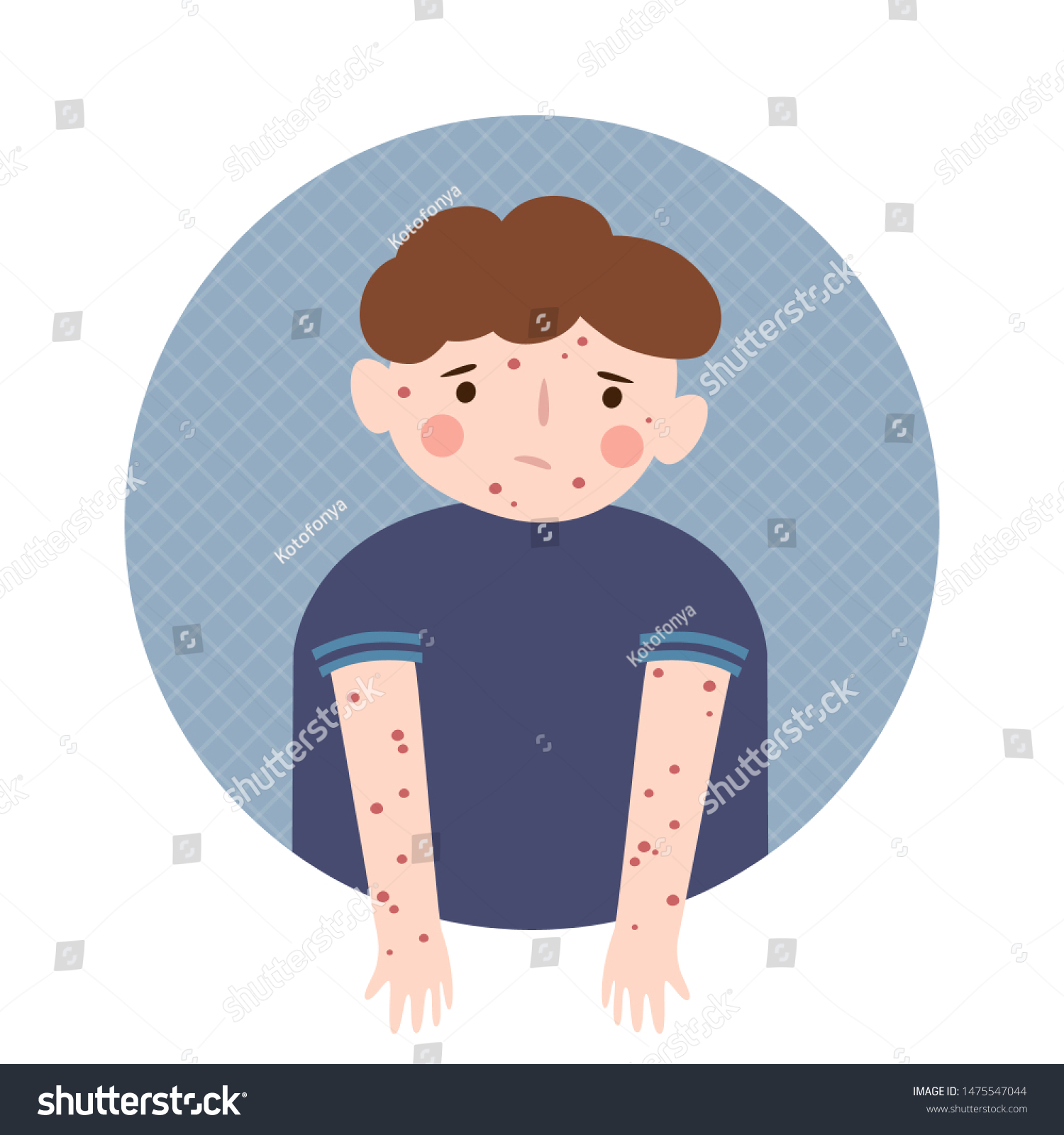 Boy Rash On Body Chickenpox Measles Stock Vector (Royalty Free) 1475547044