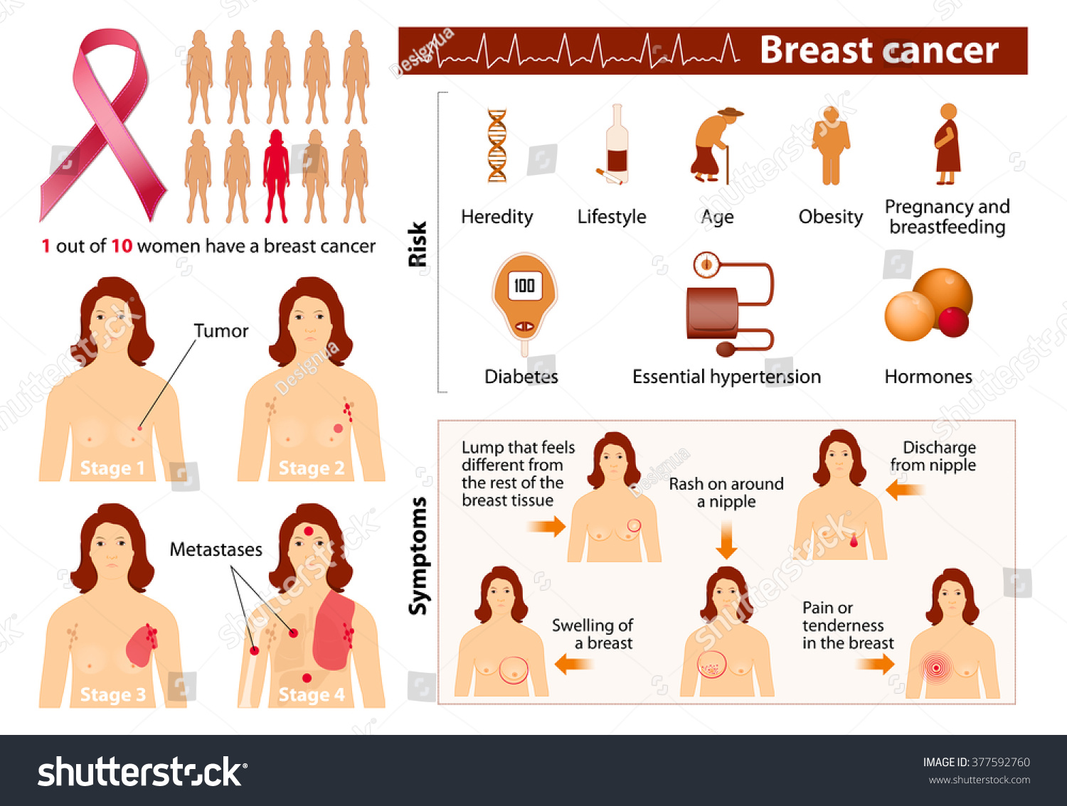 medical info on breast cancer Amateur perfect tits