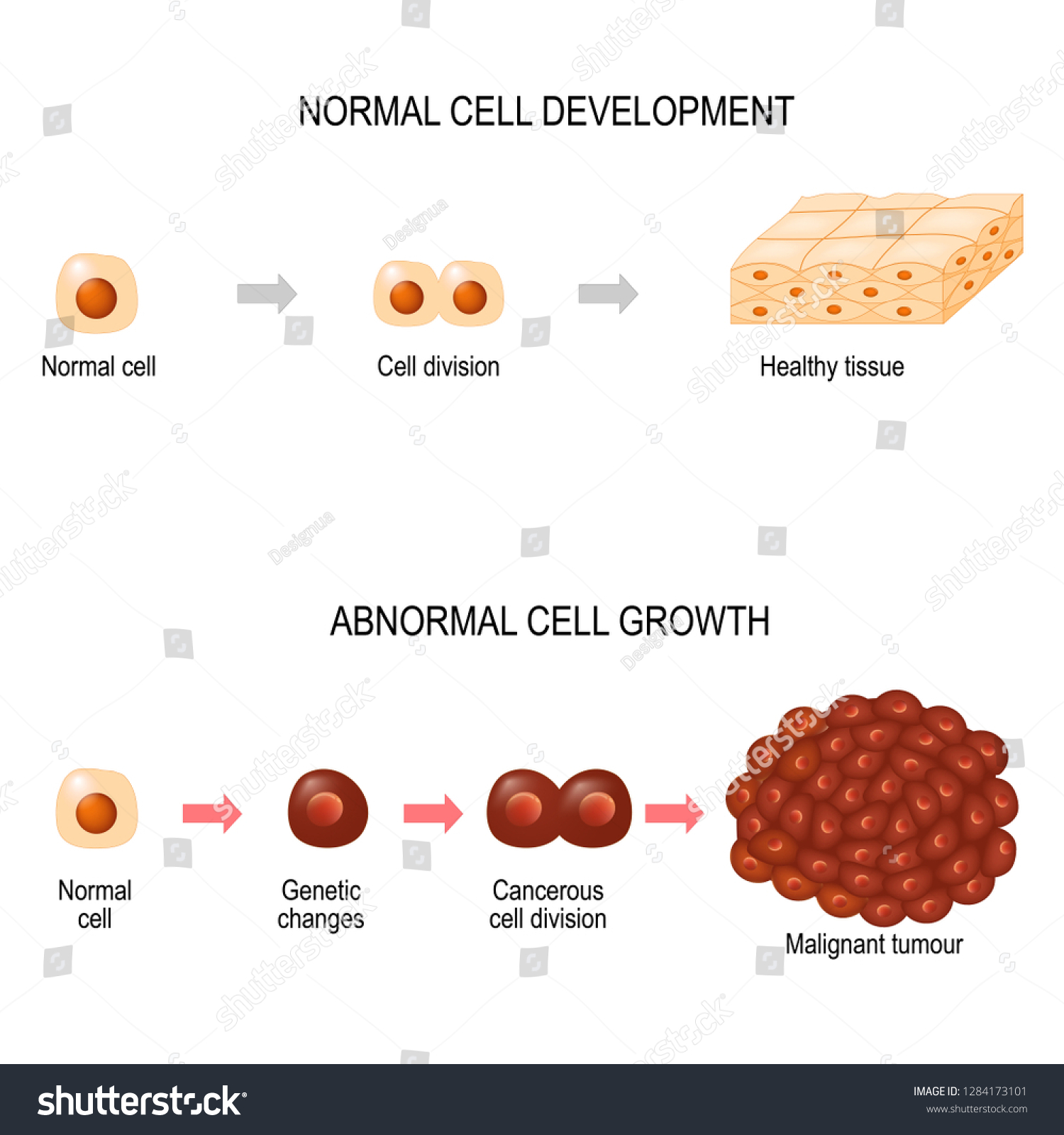 1,236 Normal and cancer cells Images, Stock Photos & Vectors | Shutterstock