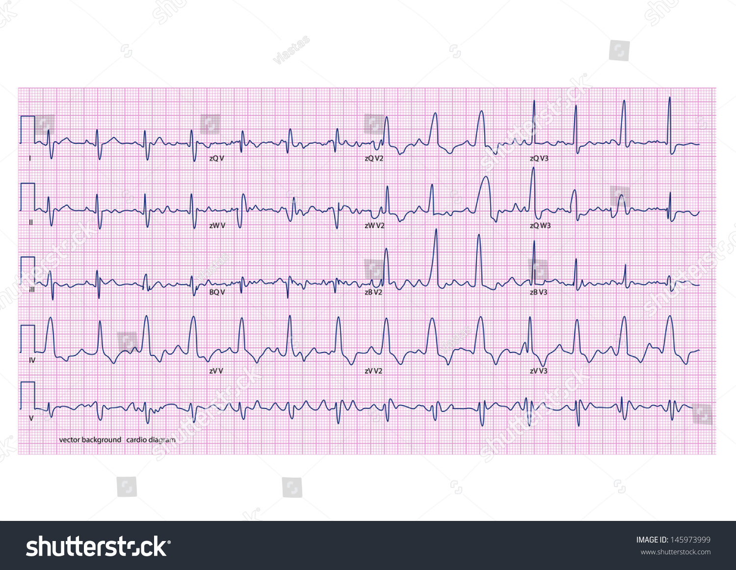 Cardiogram On Pink Grid Stock Vector Royalty Free 145973999