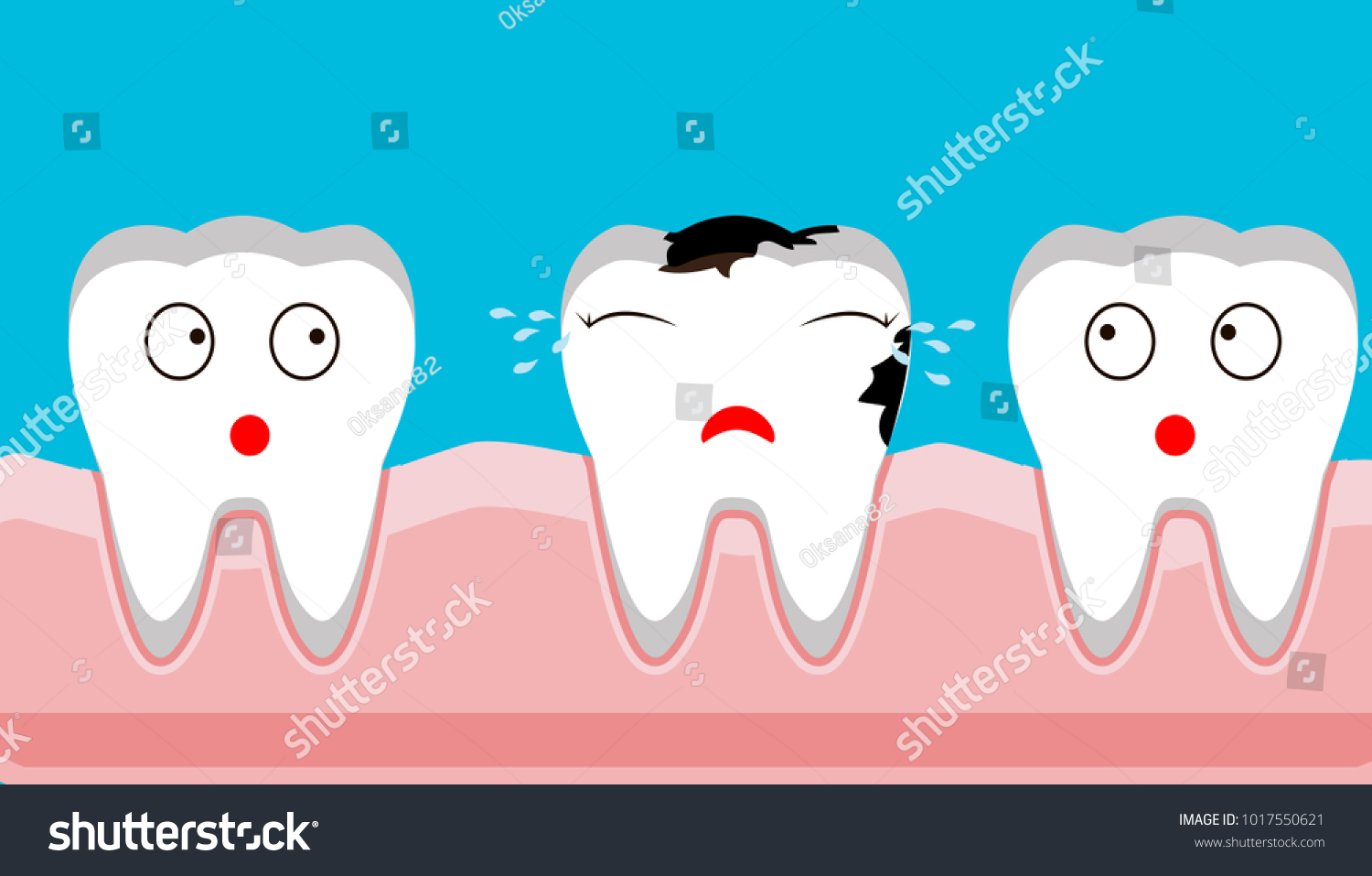 Caries Tooth Decay Disease Pain Vector เวกเตอร์สต็อก ปลอดค่าลิขสิทธิ์ 1017550621 Shutterstock