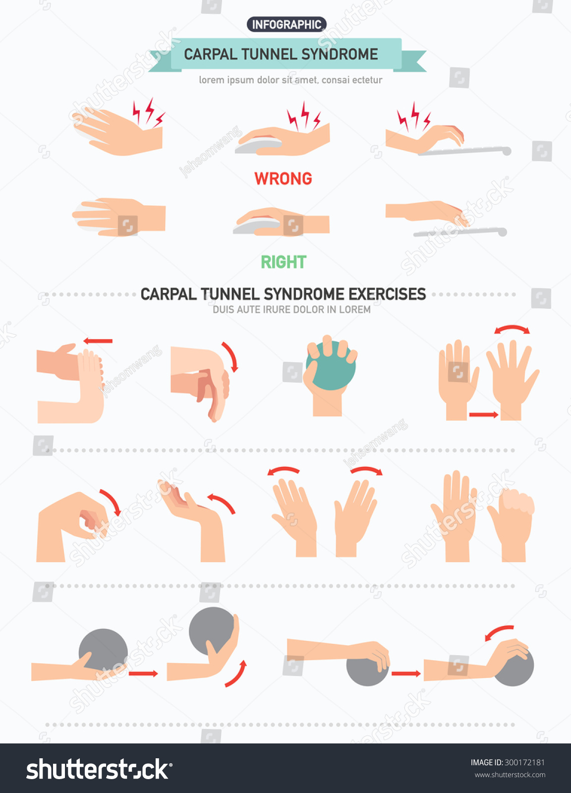 Carpal Tunnel Syndrome Infographicvector Illustration Stock Vector ...