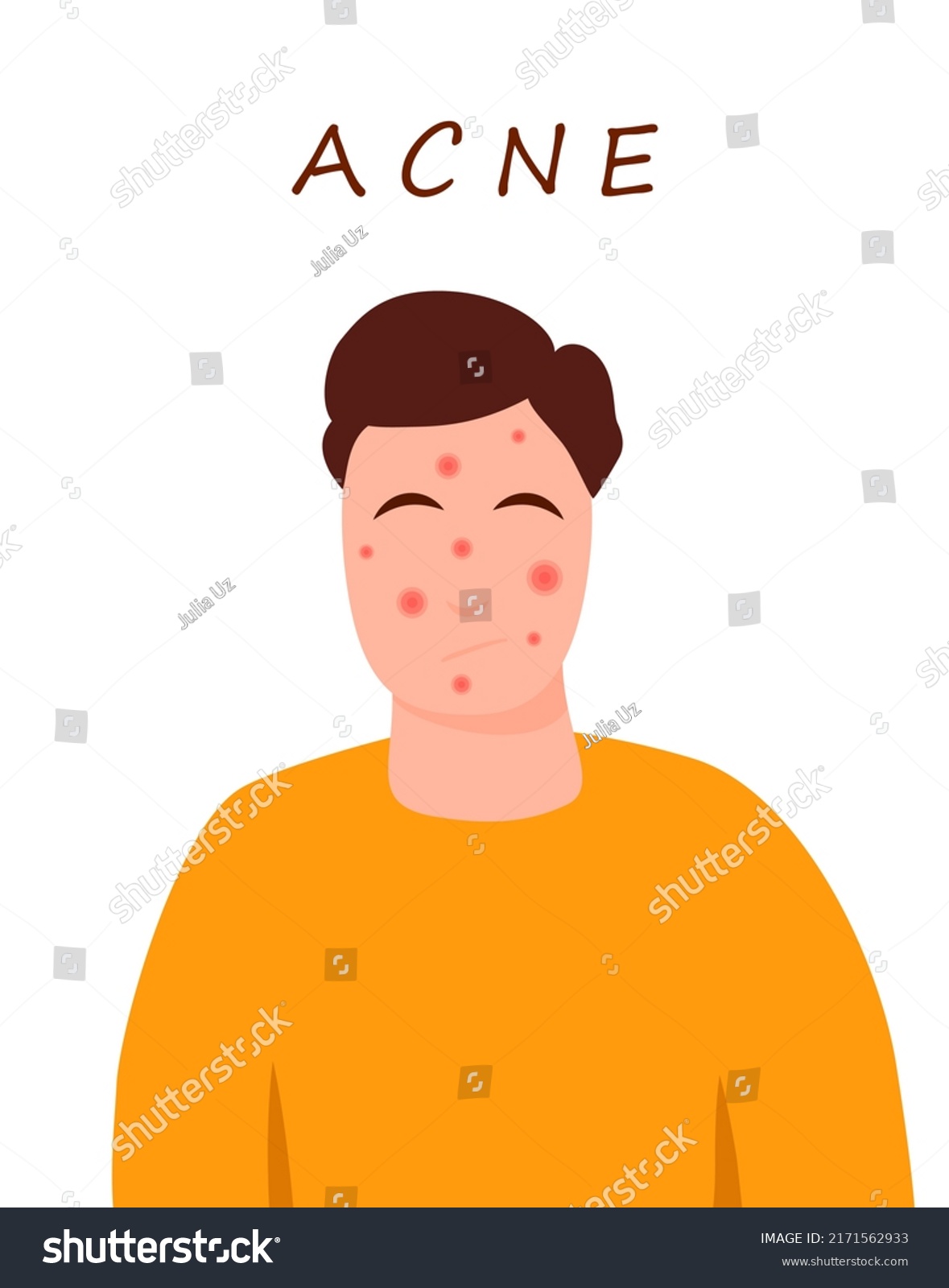 Cartoon Teenage Character Acne Skin Skin Stock Vector (royalty Free 