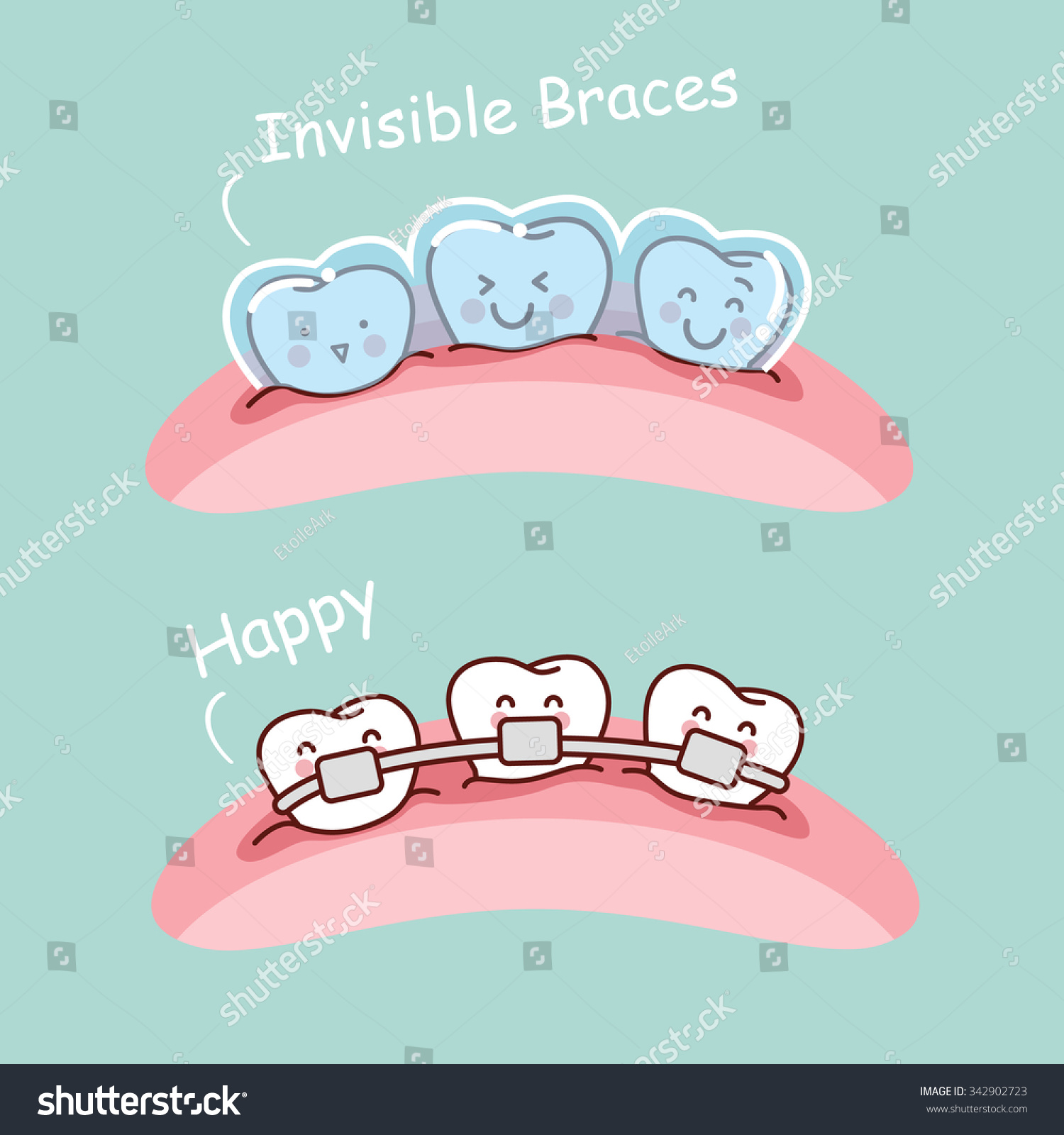 Braces Transparent Clip Art – Cliparts