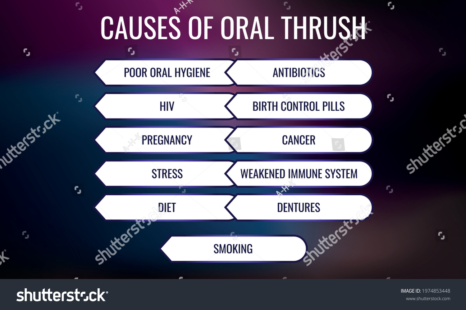 causes-oral-thrush-vector-illustration-medical-stock-vector-royalty