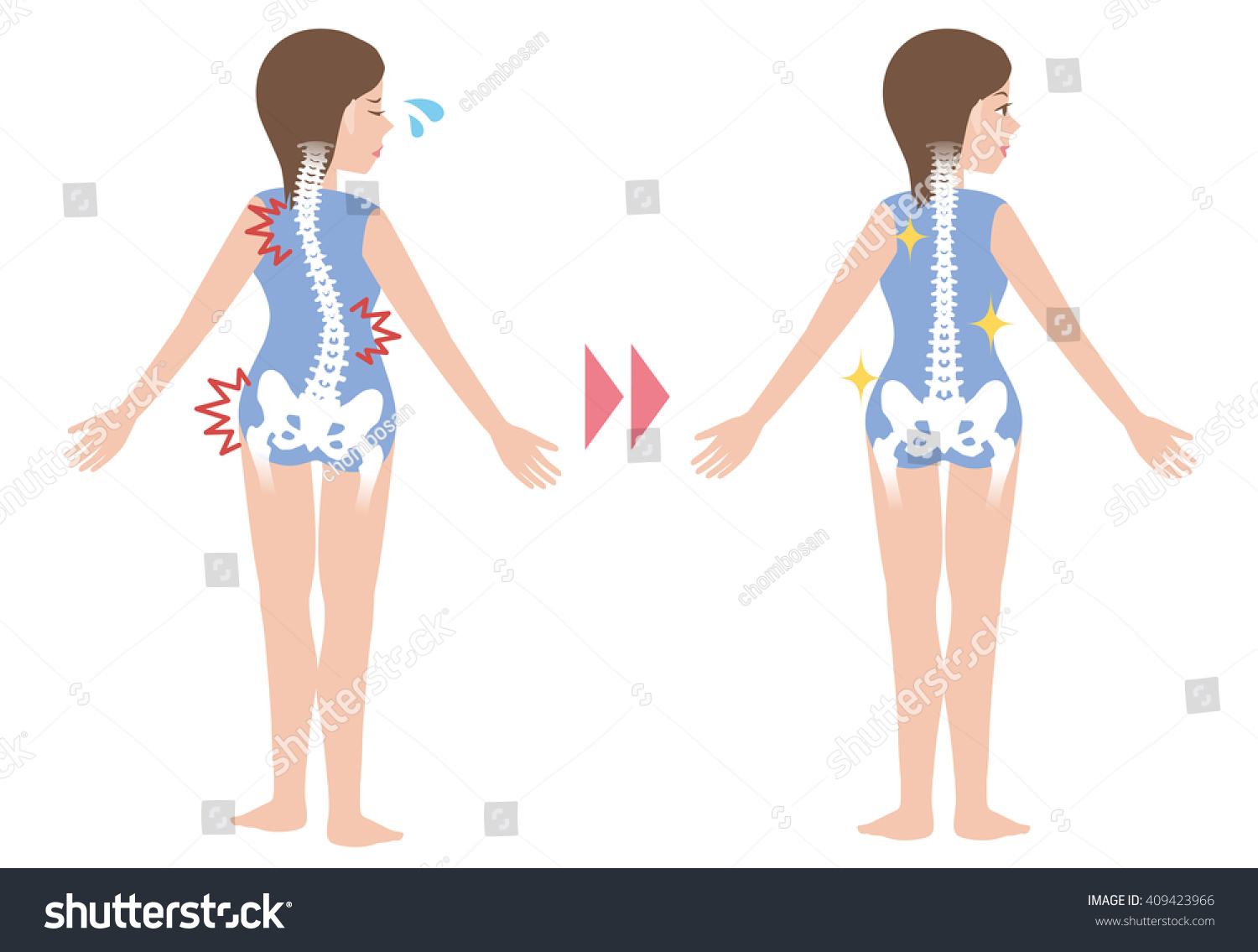 Chiropractic Before After Image Bad Posture Stock Vector (royalty Free 