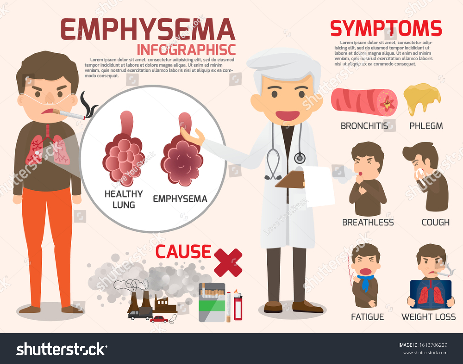 Chronic Obstructive Pulmonary Disease Copd Pulmonary のベクター画像素材 ロイヤリティフリー