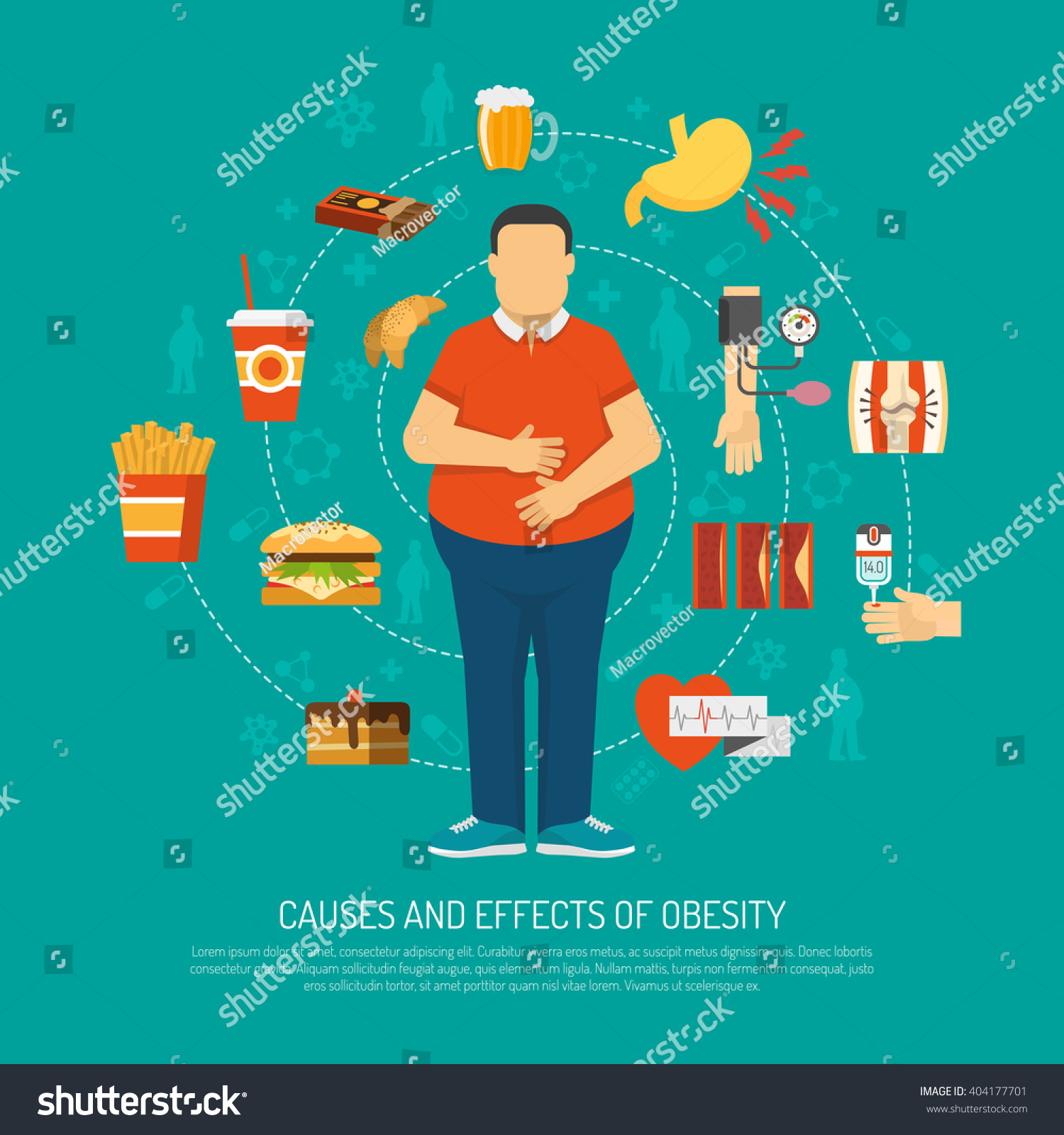 Color Illustration Causes Effects Obesity Vector Stock Vector (Royalty ...