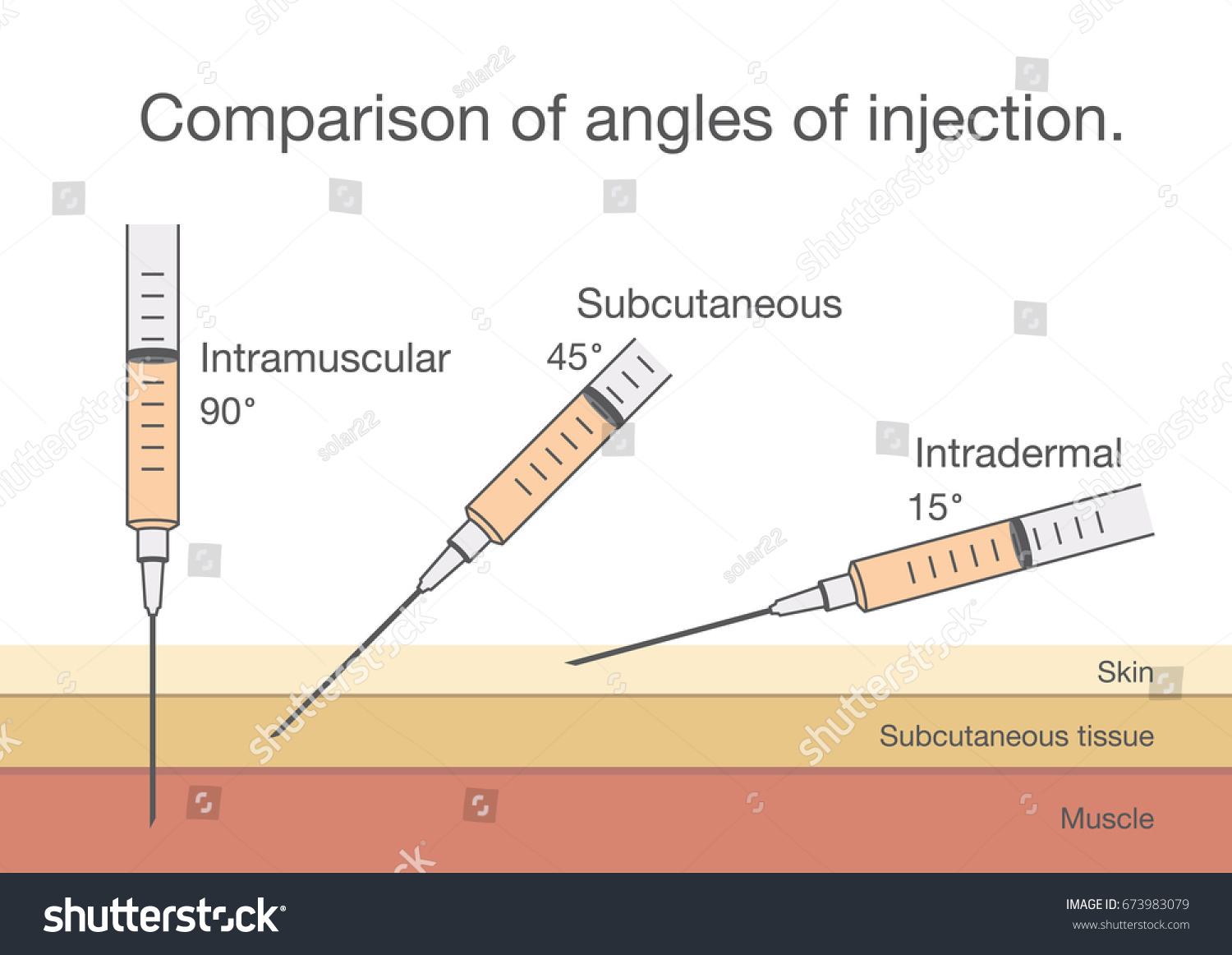Types Of Injections And Angles