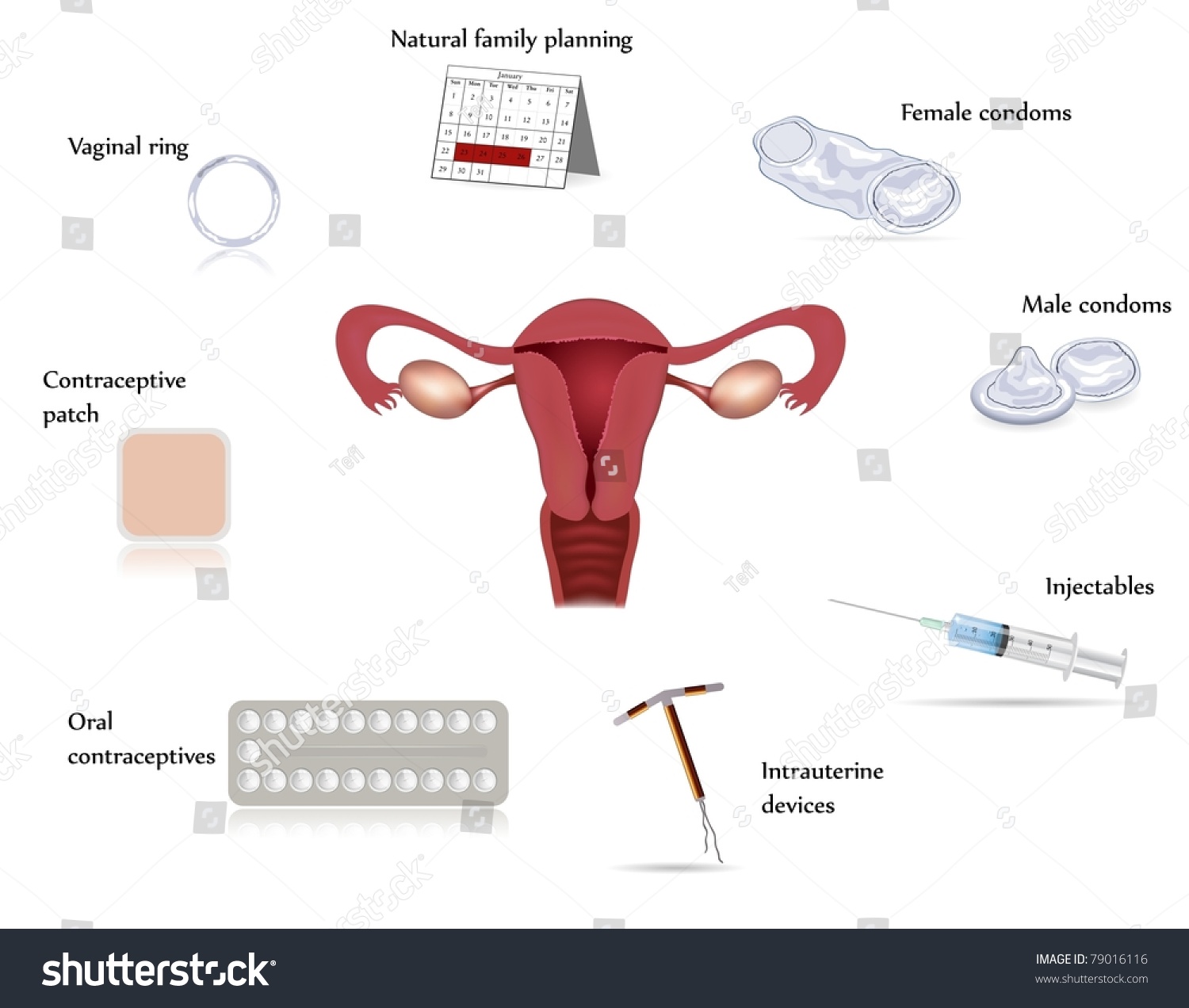 The spiral is intrauterine. Reviews about her 5 The spiral is intrauterine. Reviews about her 70