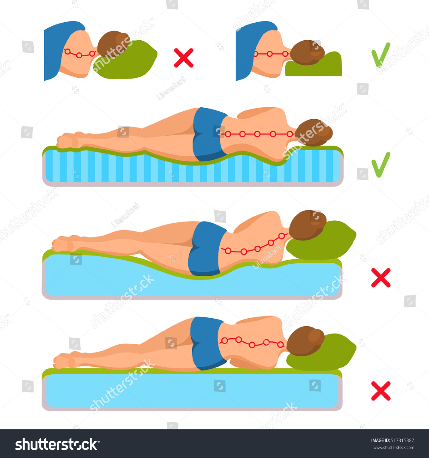 SVG of Correct and incorrect curvature of the spine in various mattresses. Orthopedic mattress and pillow. Woman lies on her side, seen from behind. Caring for health of back, neck. Comparative illustration. svg