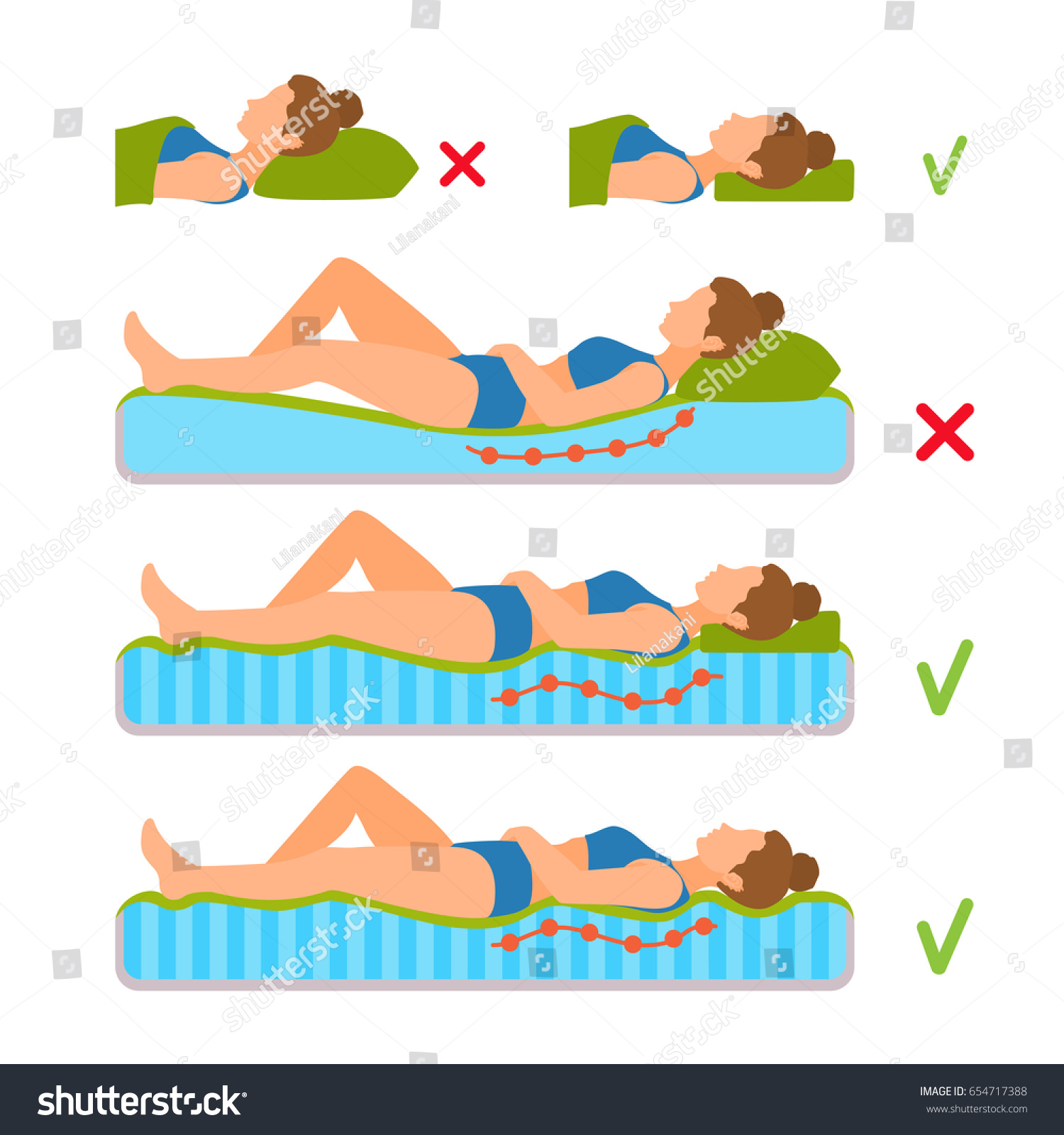 How to correct the curvature of the spine at home: exercises 36 How to correct the curvature of the spine at home: exercises 70