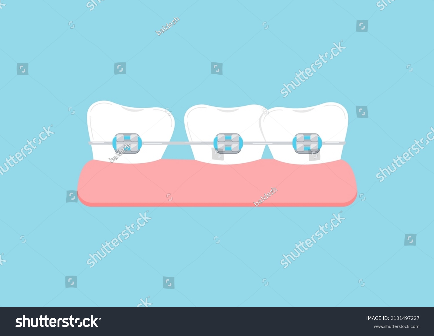 7,743 Braces graphic Images, Stock Photos & Vectors | Shutterstock