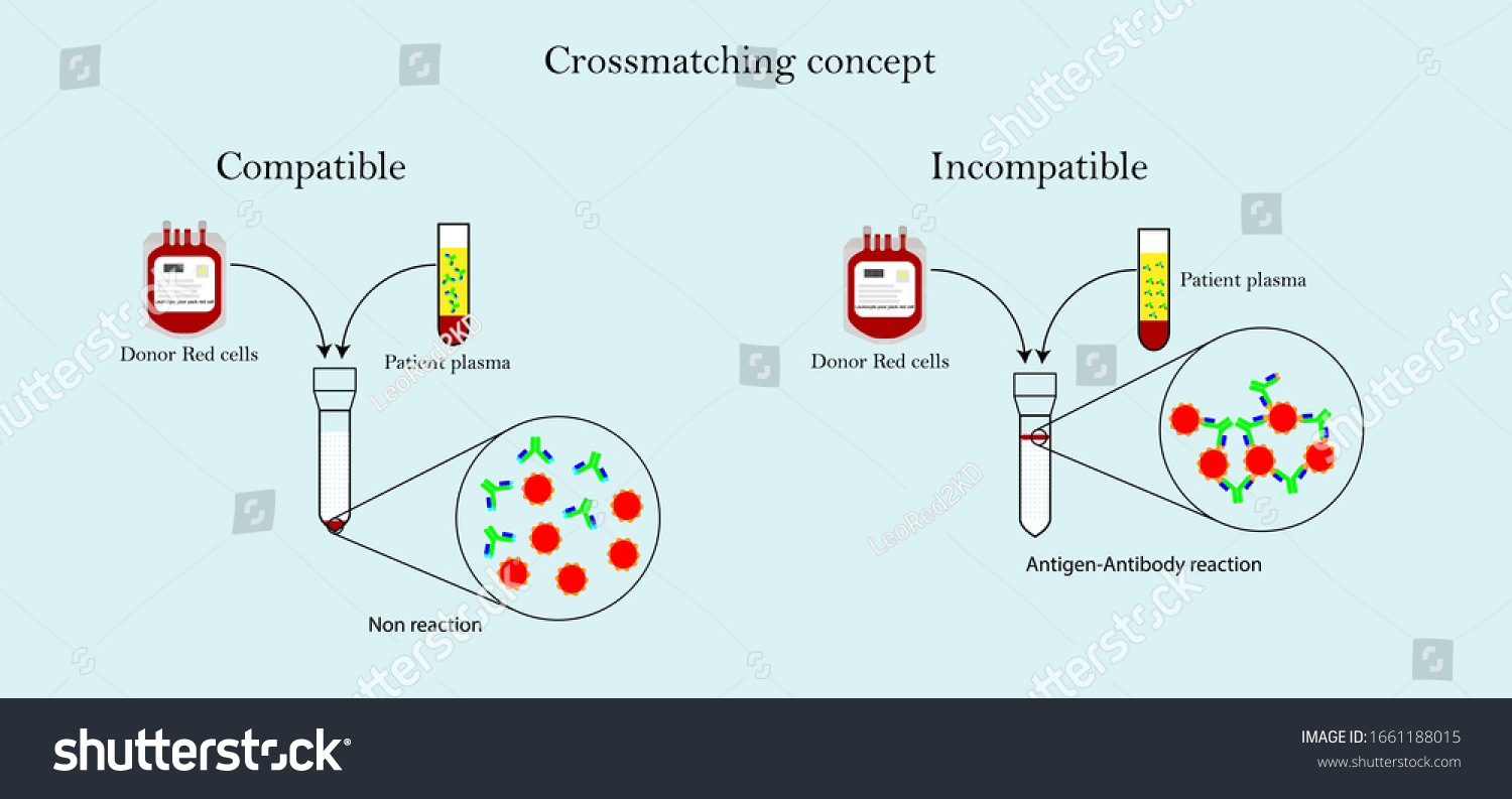 crossmatching-images-stock-photos-vectors-shutterstock