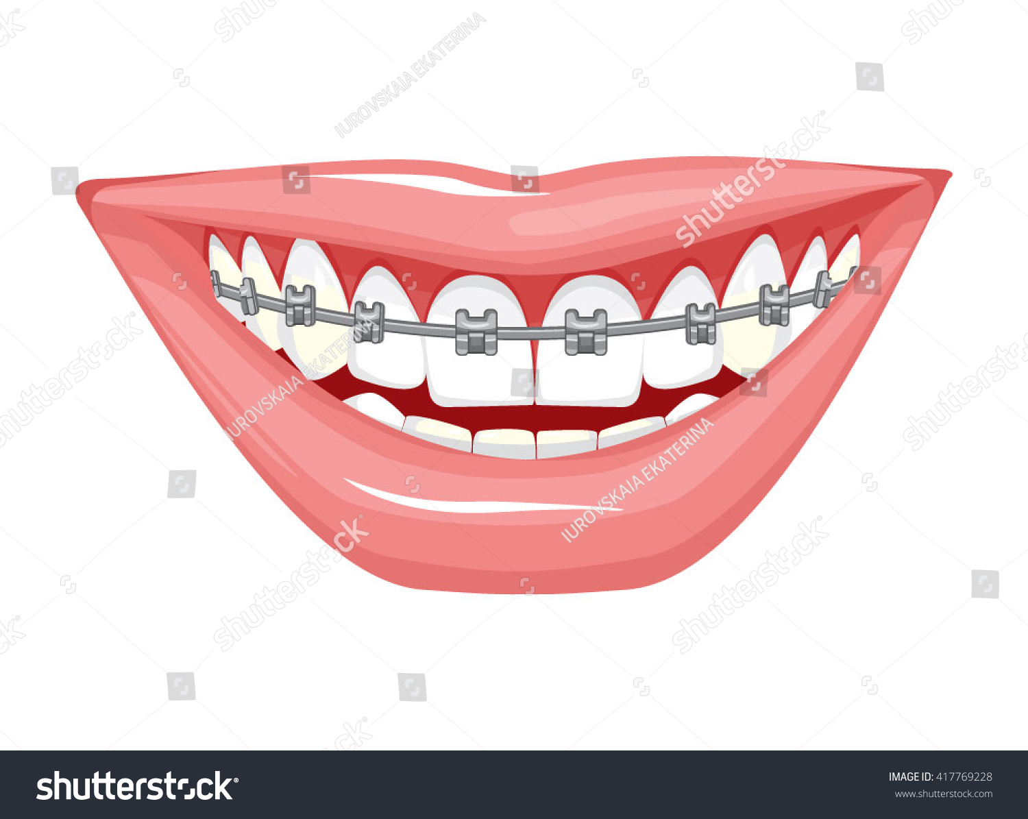 Free Free Smile With Braces Svg 17 SVG PNG EPS DXF File