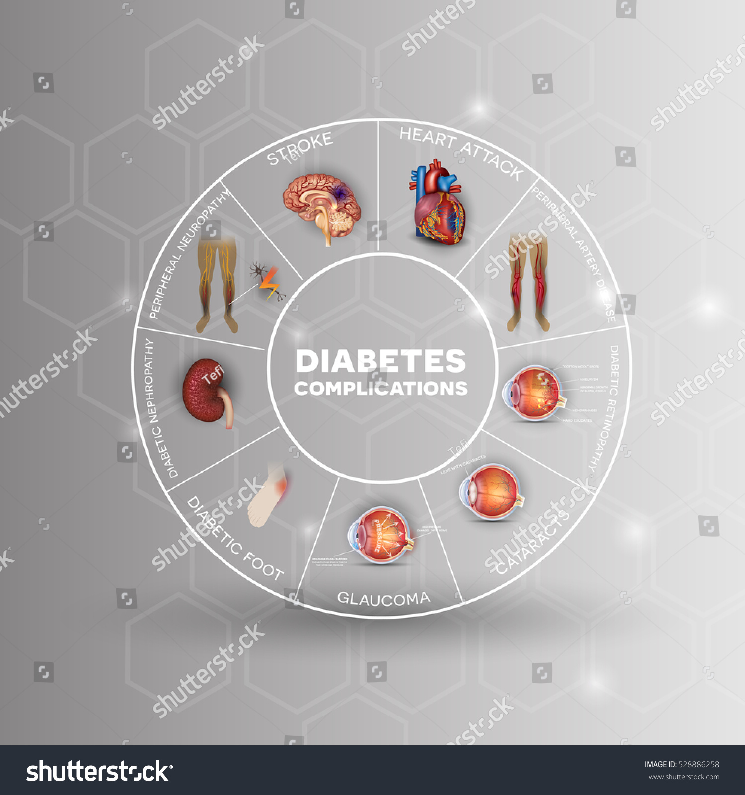 Los nervios diabetes daña la