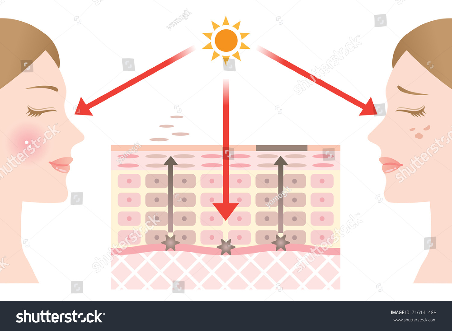 Diagram Skin Cell Turnover Skin Spots Stock Vector (Royalty Free ...