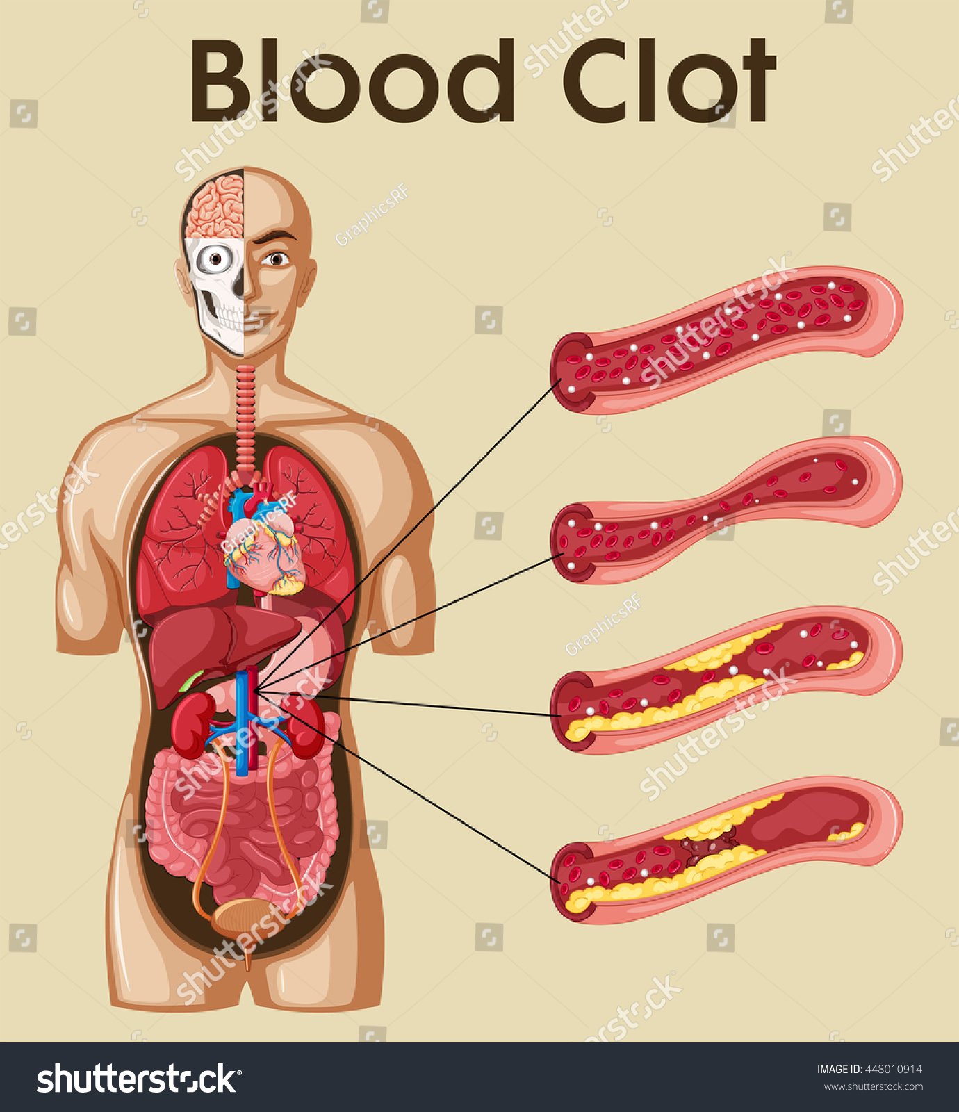 blood clot clipart - photo #15