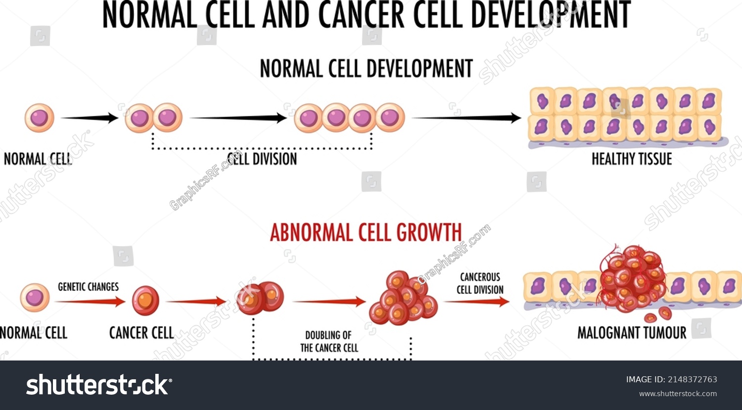 Diagram Showing Normal Cancer Cell Illustration Stock Vector (Royalty ...