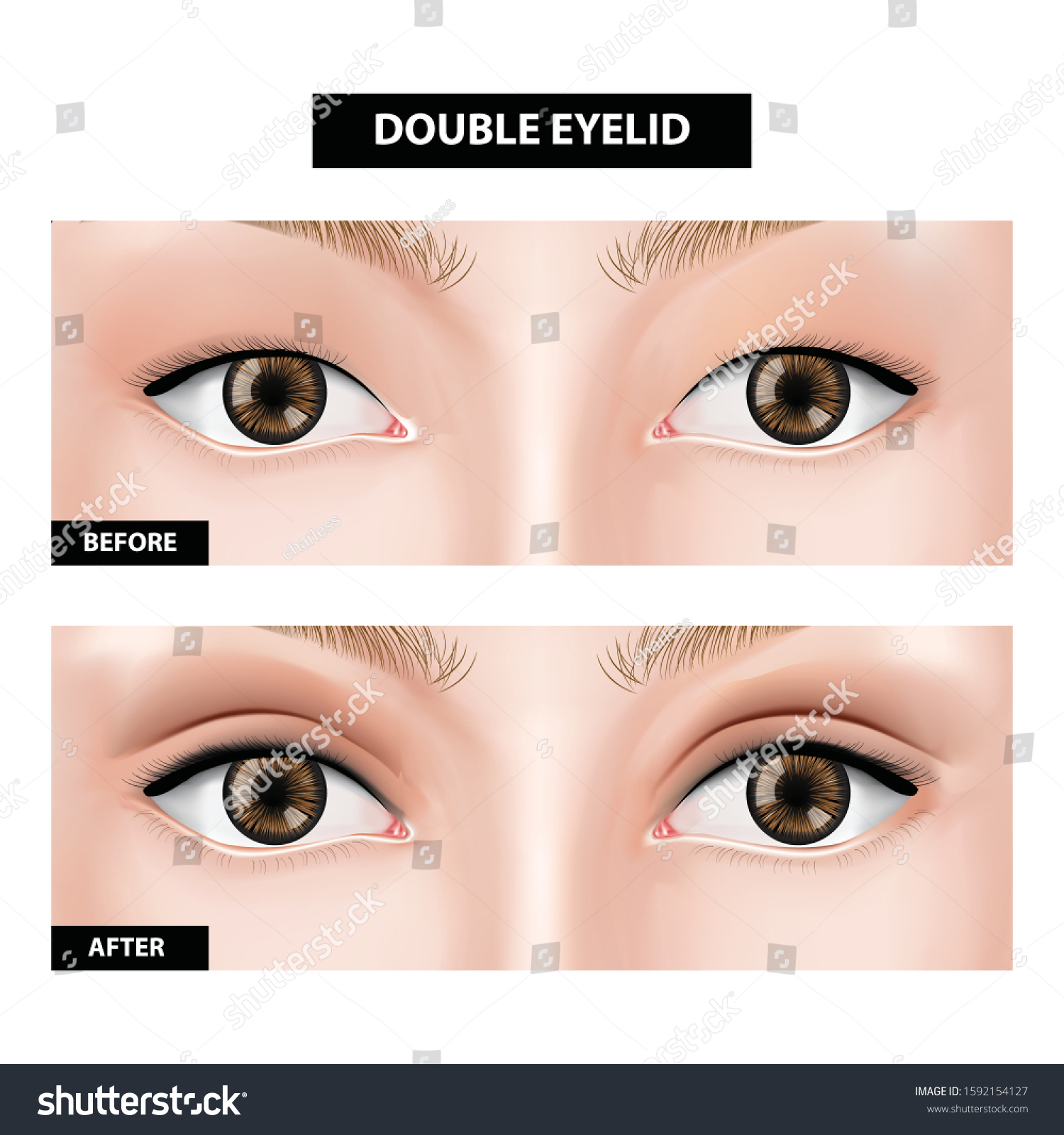 double eyelid app