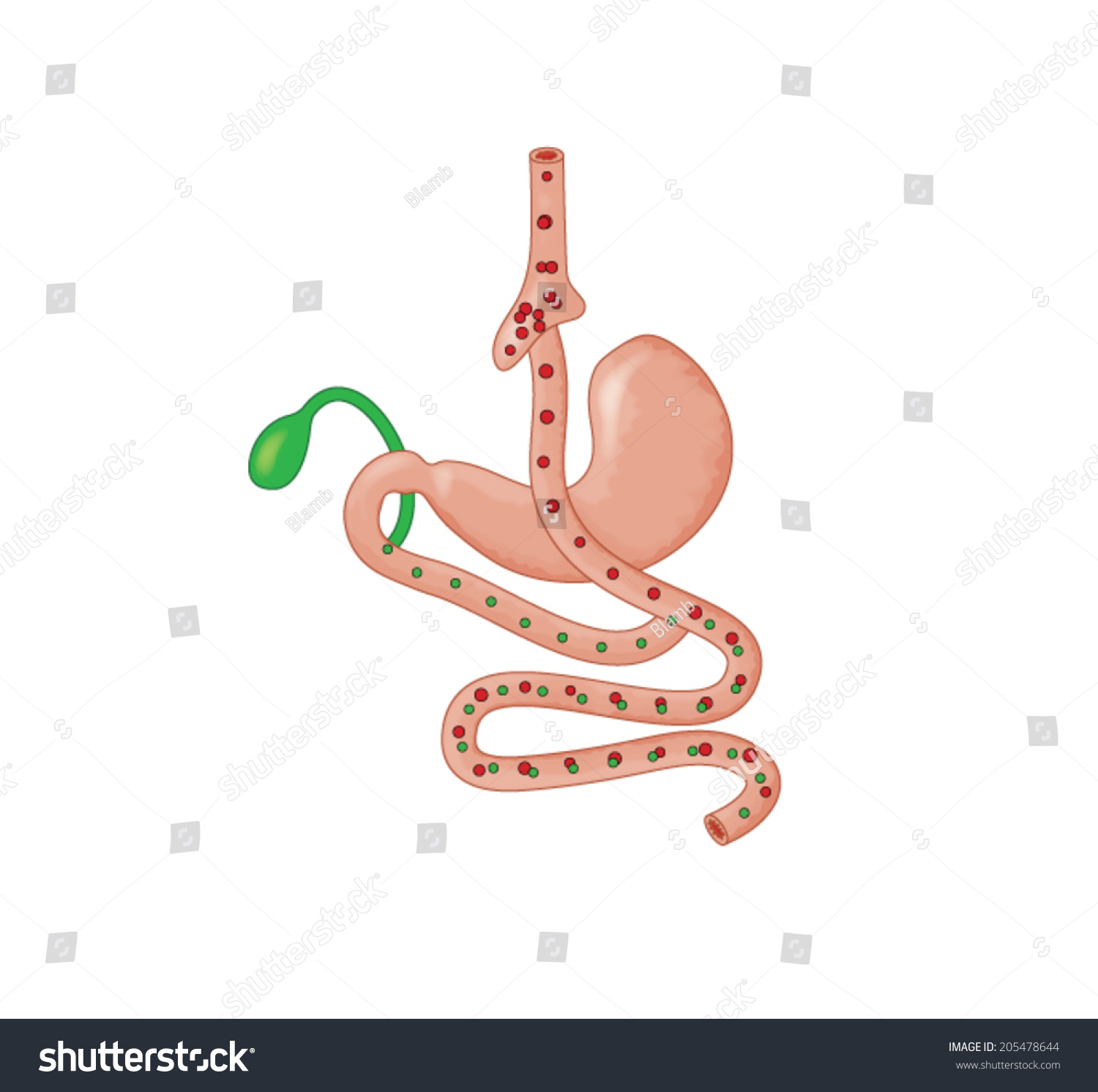 Vektor Stok Drawing Bariatric Surgery Showing Rouxeny Gastric Tanpa