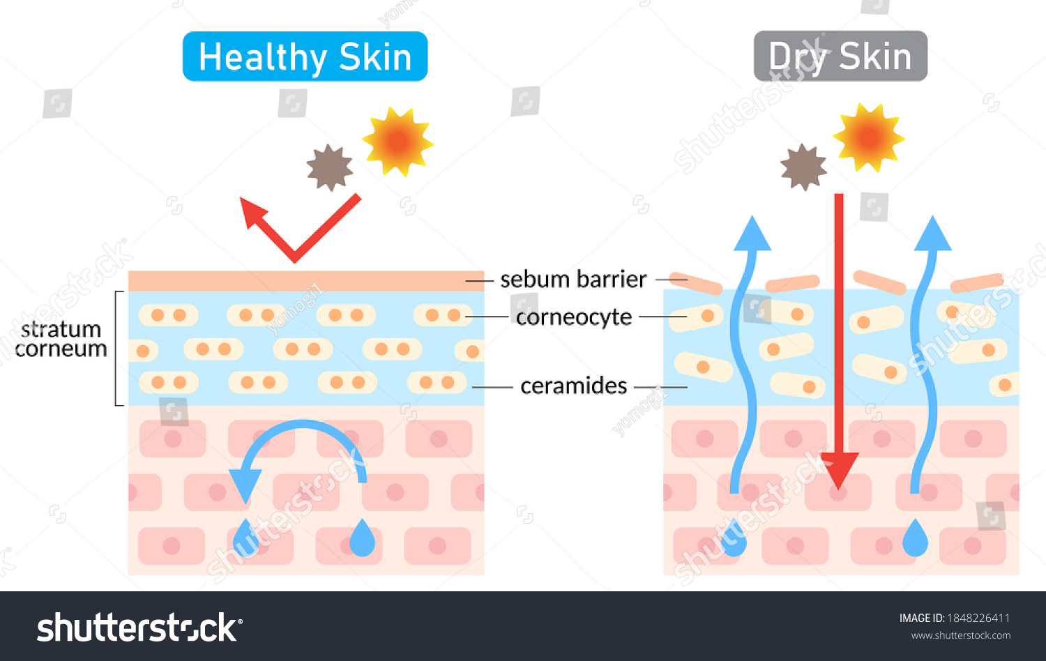 1,519 Skin barrier Images, Stock Photos & Vectors | Shutterstock