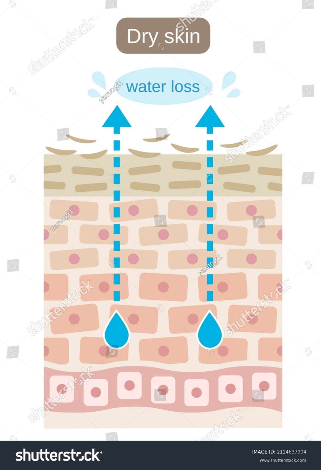 Dry Skin Cell Layer Illustration Moisture Stock Vector (Royalty Free ...