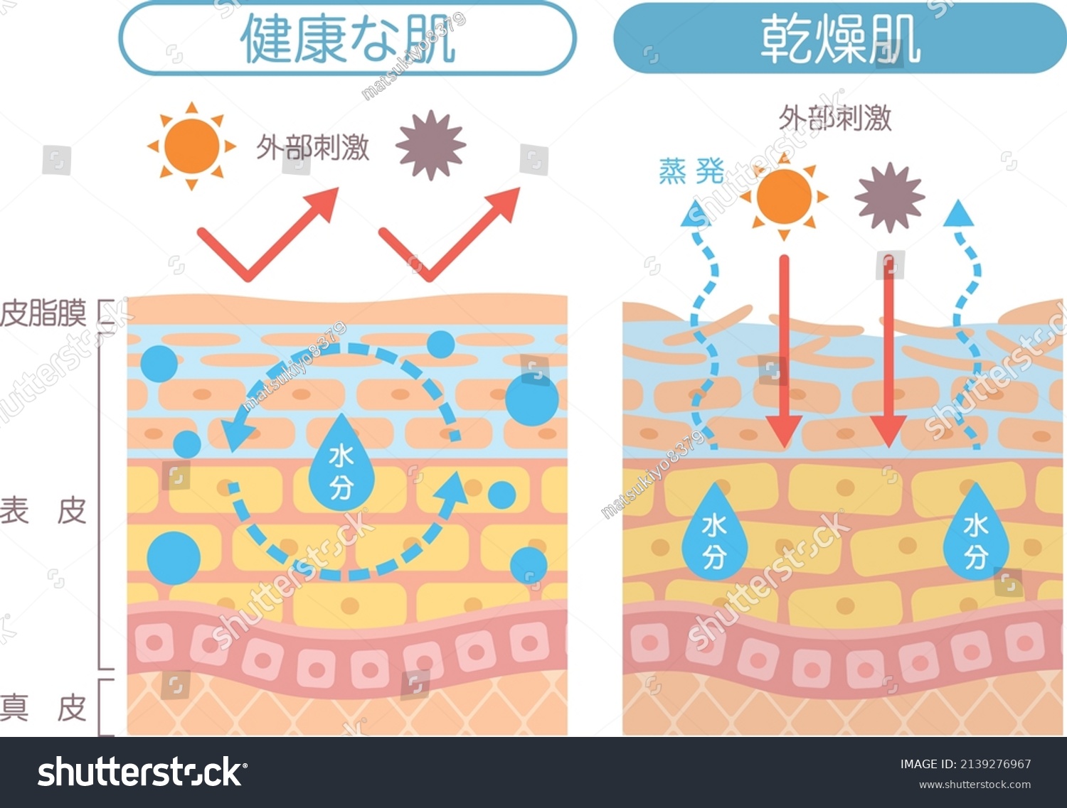 16 Dermis evaporative Images, Stock Photos & Vectors | Shutterstock