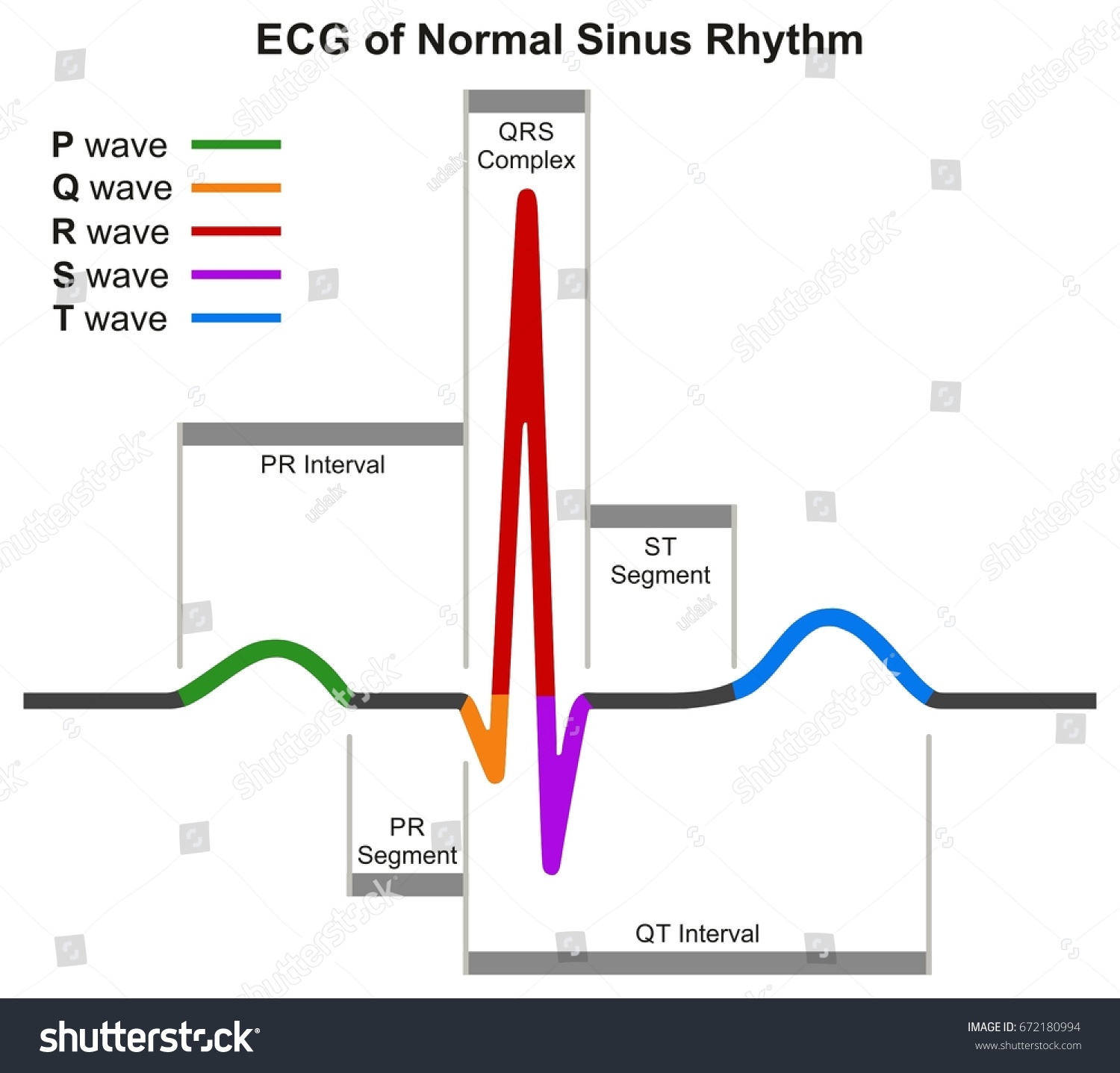 Ecg Normal Sinus Rhythm Infographic Diagram Stock Vector ...