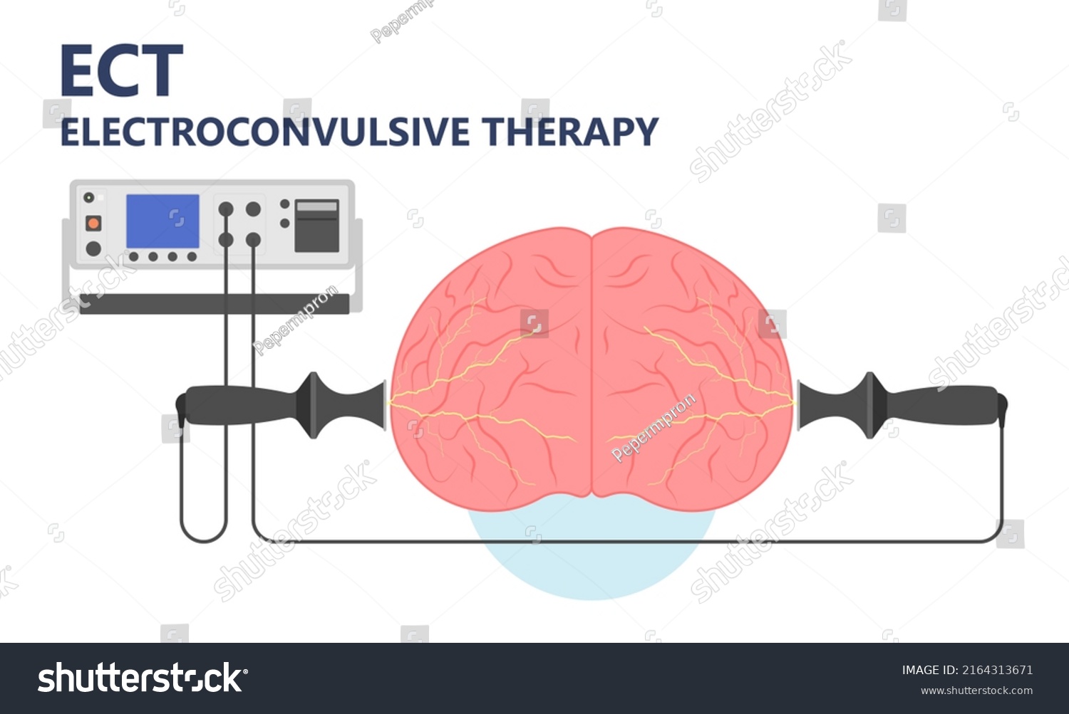 Ect Treat Mdd Major Tms Electric Stock Vector (Royalty Free) 2164313671 ...