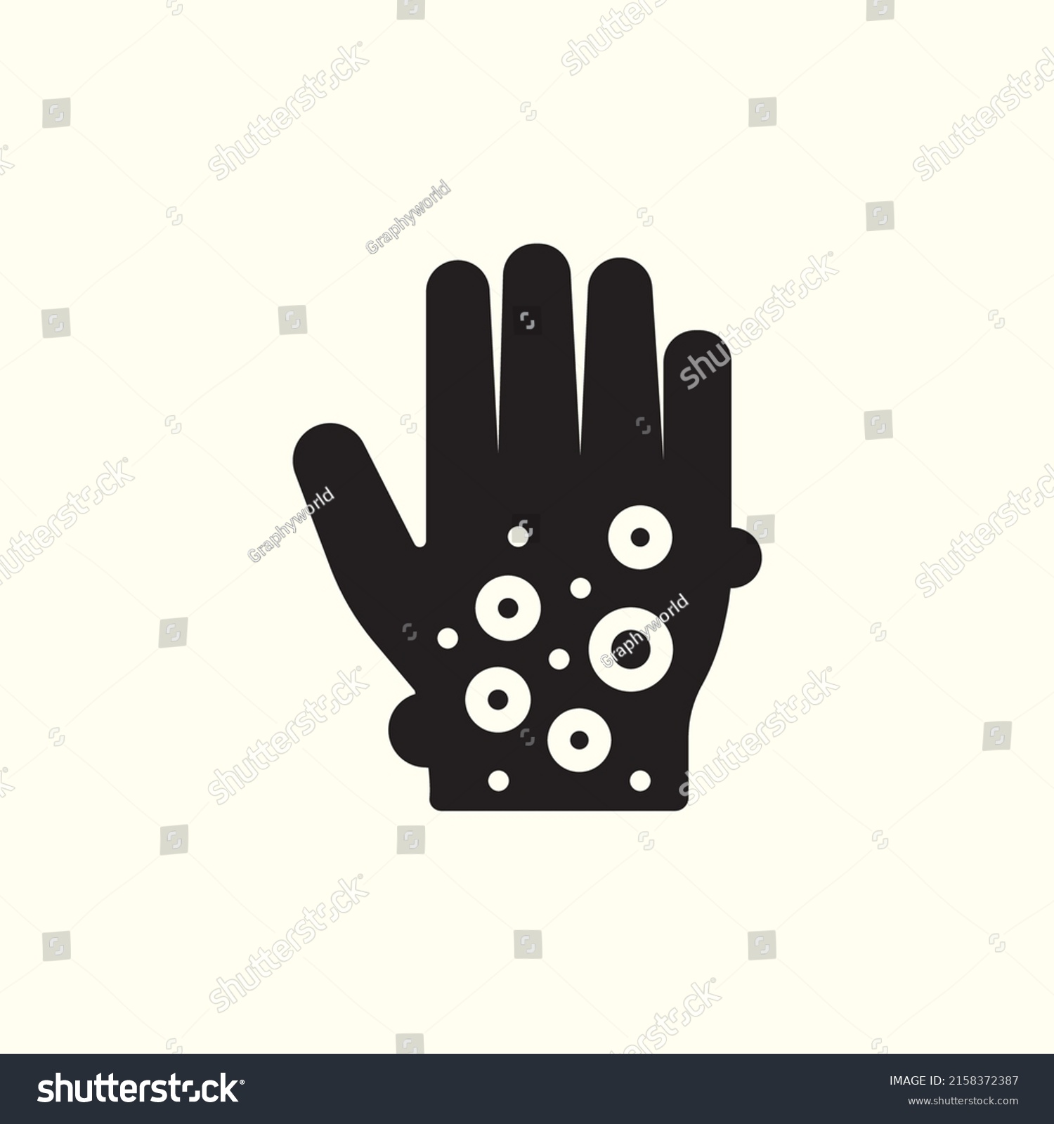 3,209 Blisters on hand vector Images, Stock Photos & Vectors | Shutterstock