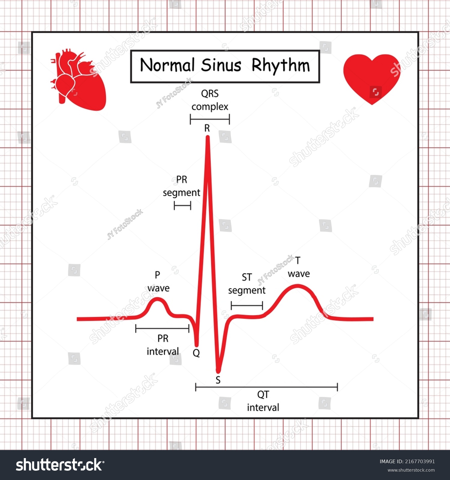 Electrocardiogram Show Normal Heart Beat Line Stock Vector (Royalty ...