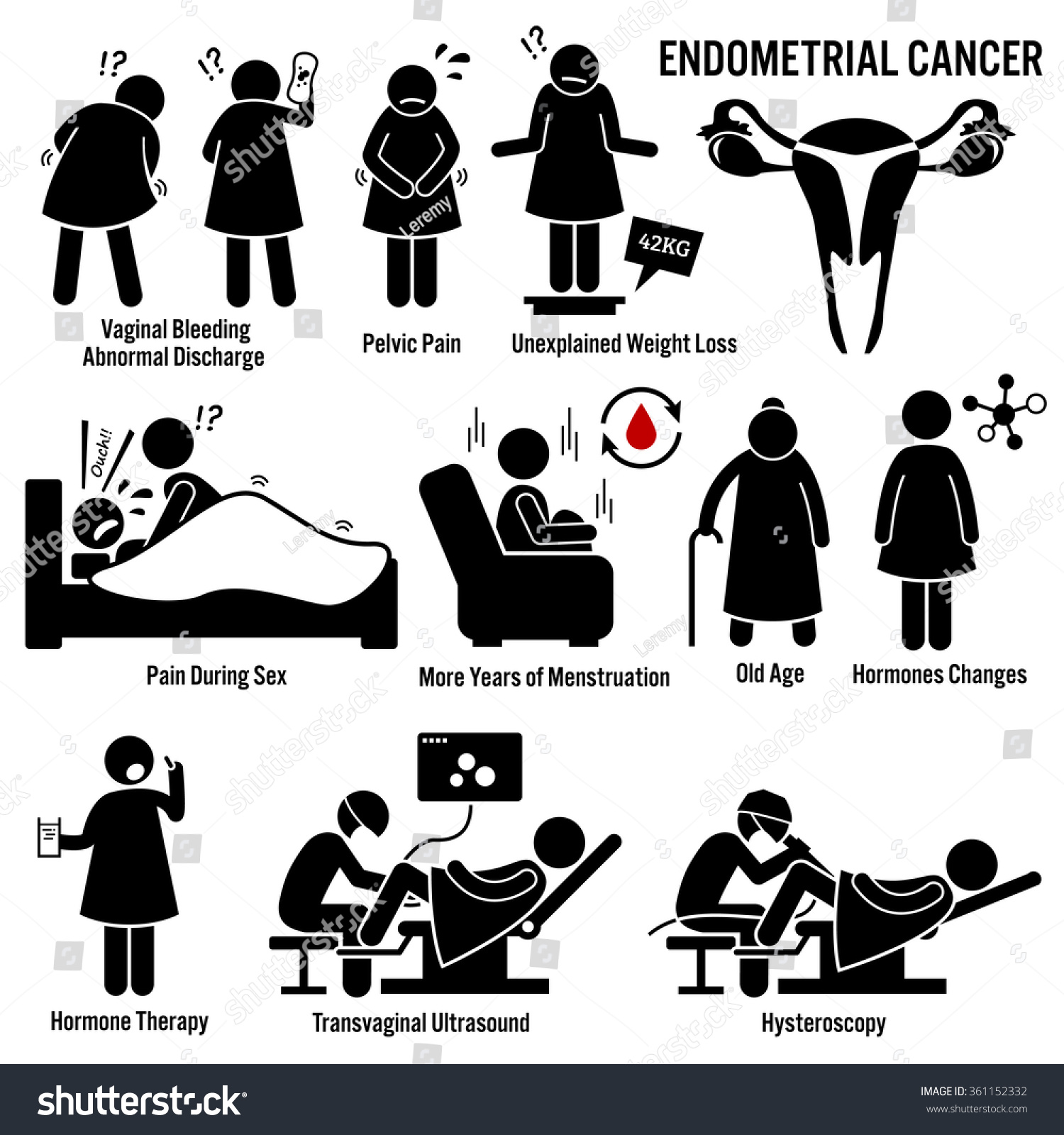 Endometrial Cancer Causes Early Signs Symptoms Treatment 5224