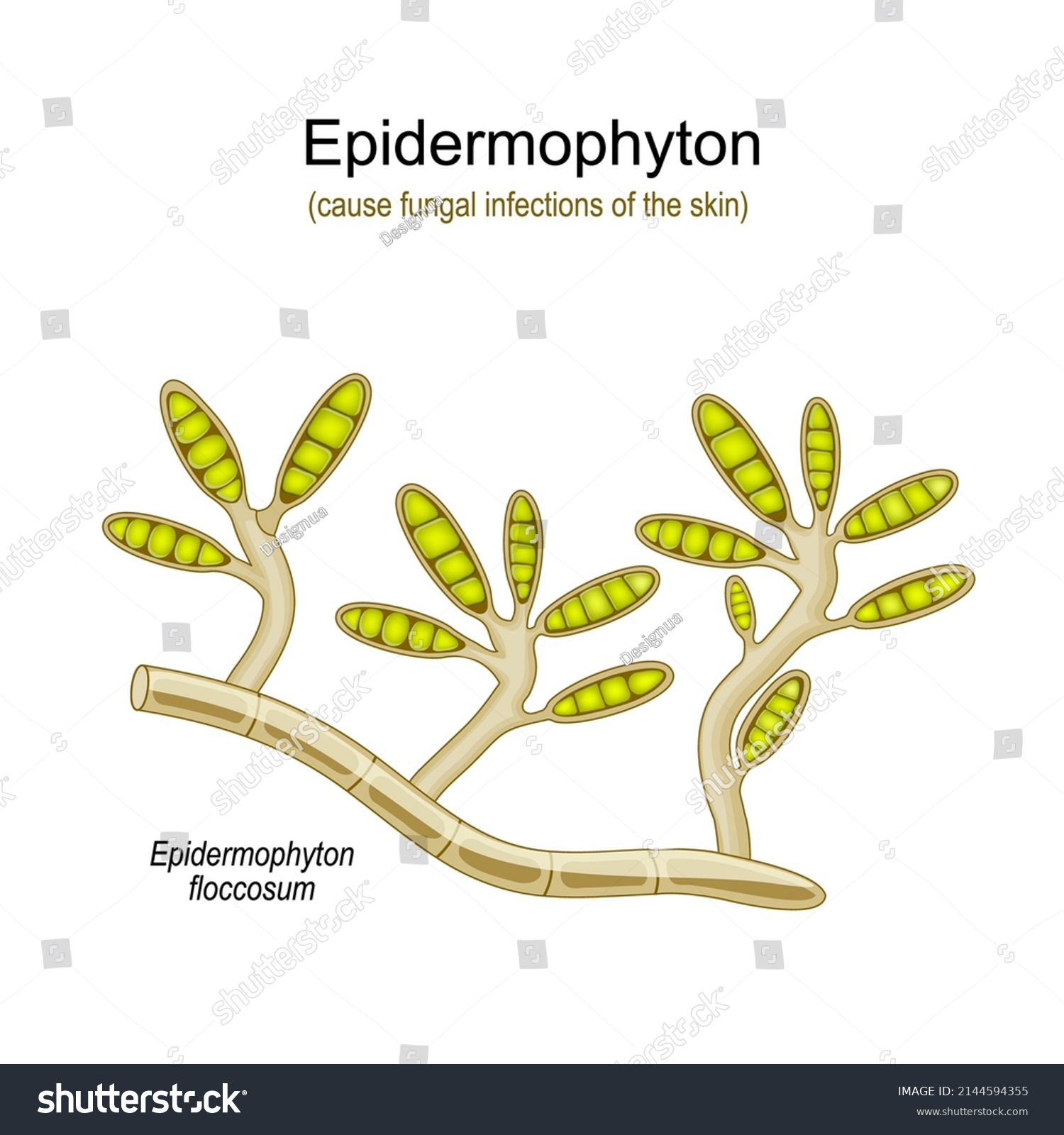 Epidermophyton Floccosum Fungal Infections Skin Vector Stock Vector ...