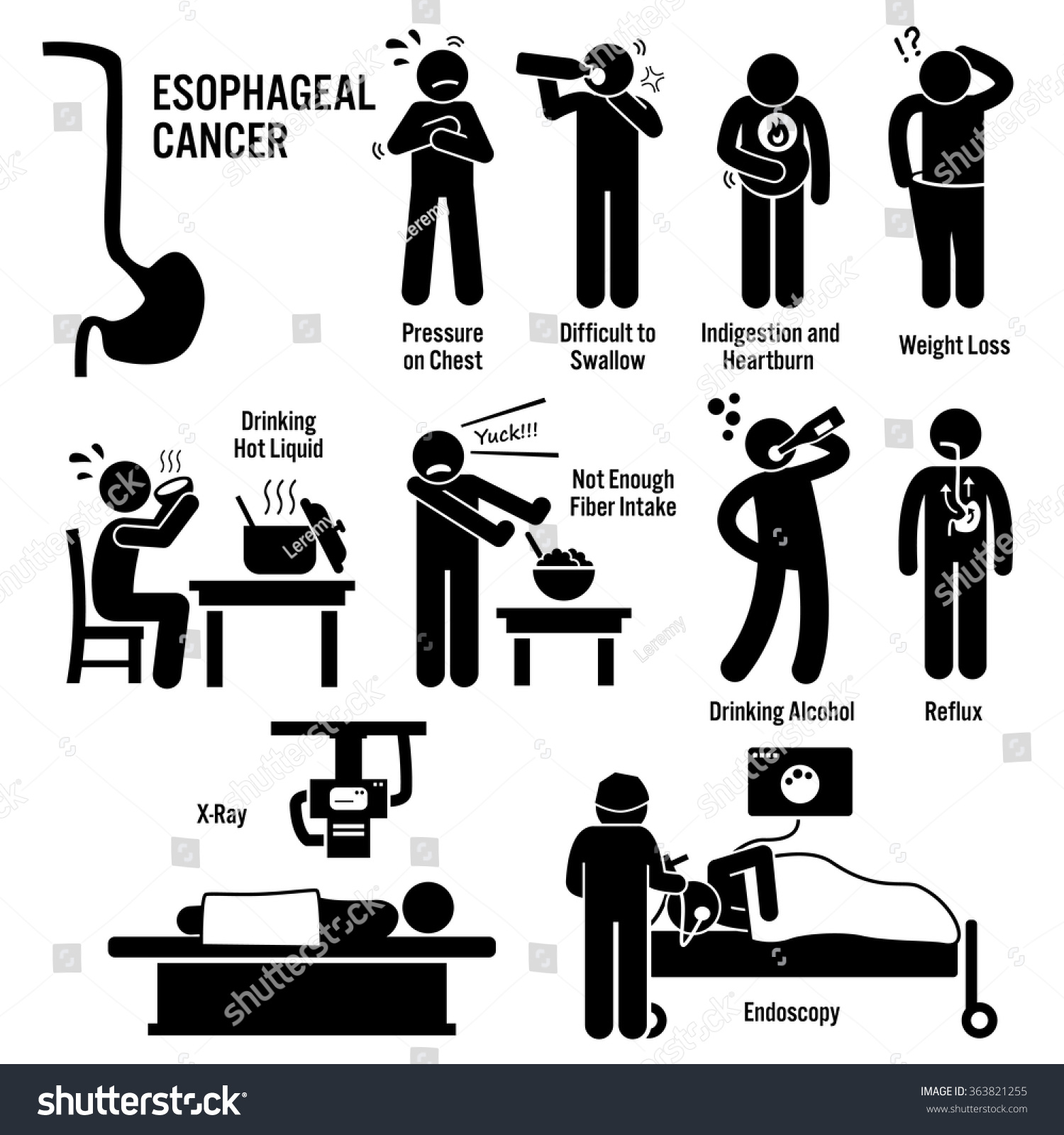 cancer of the esophagus early symptoms