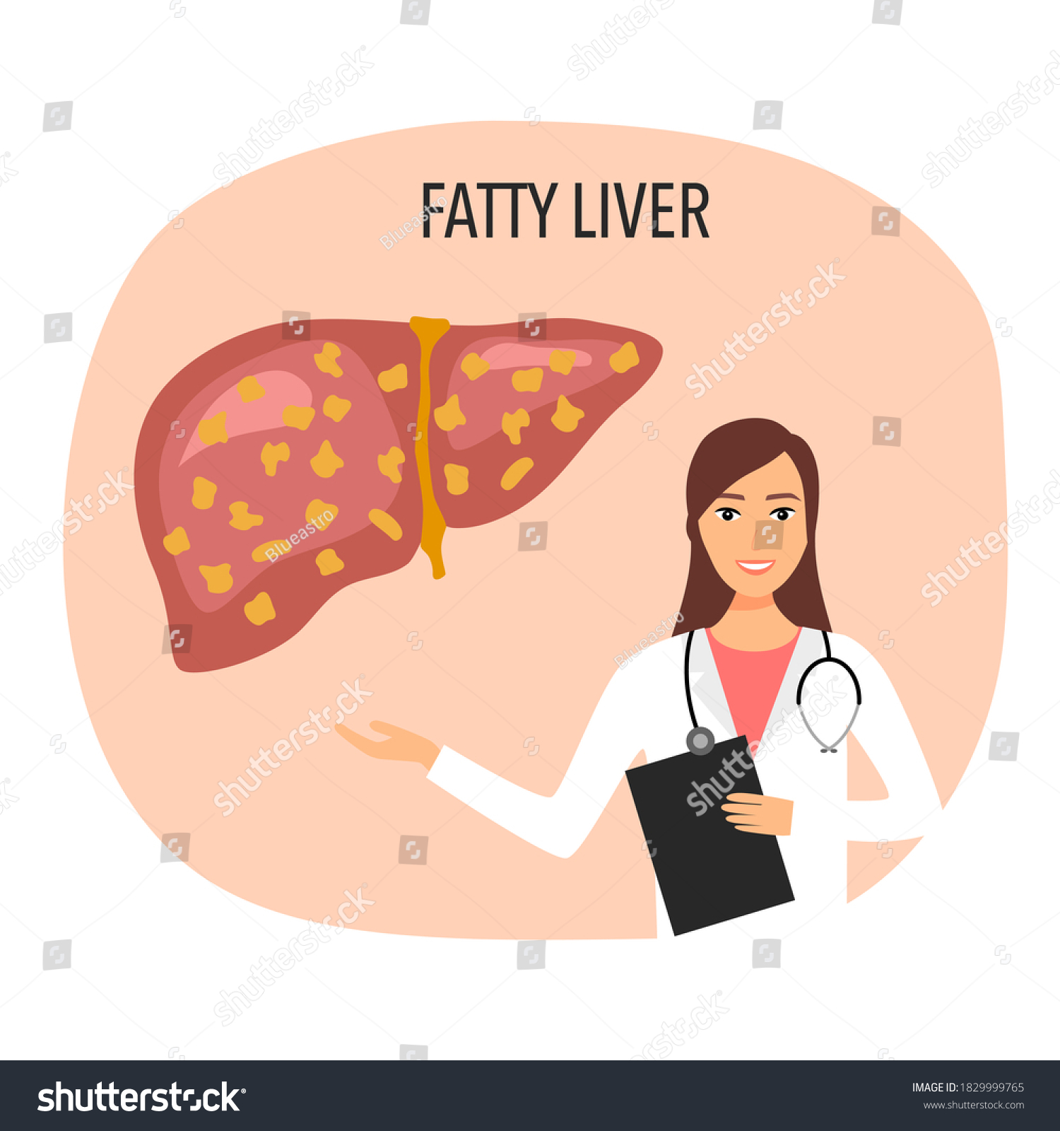 Fatty Liver Disease Doctor Vector Illustration Stock Vector Royalty Free 1829999765 Shutterstock