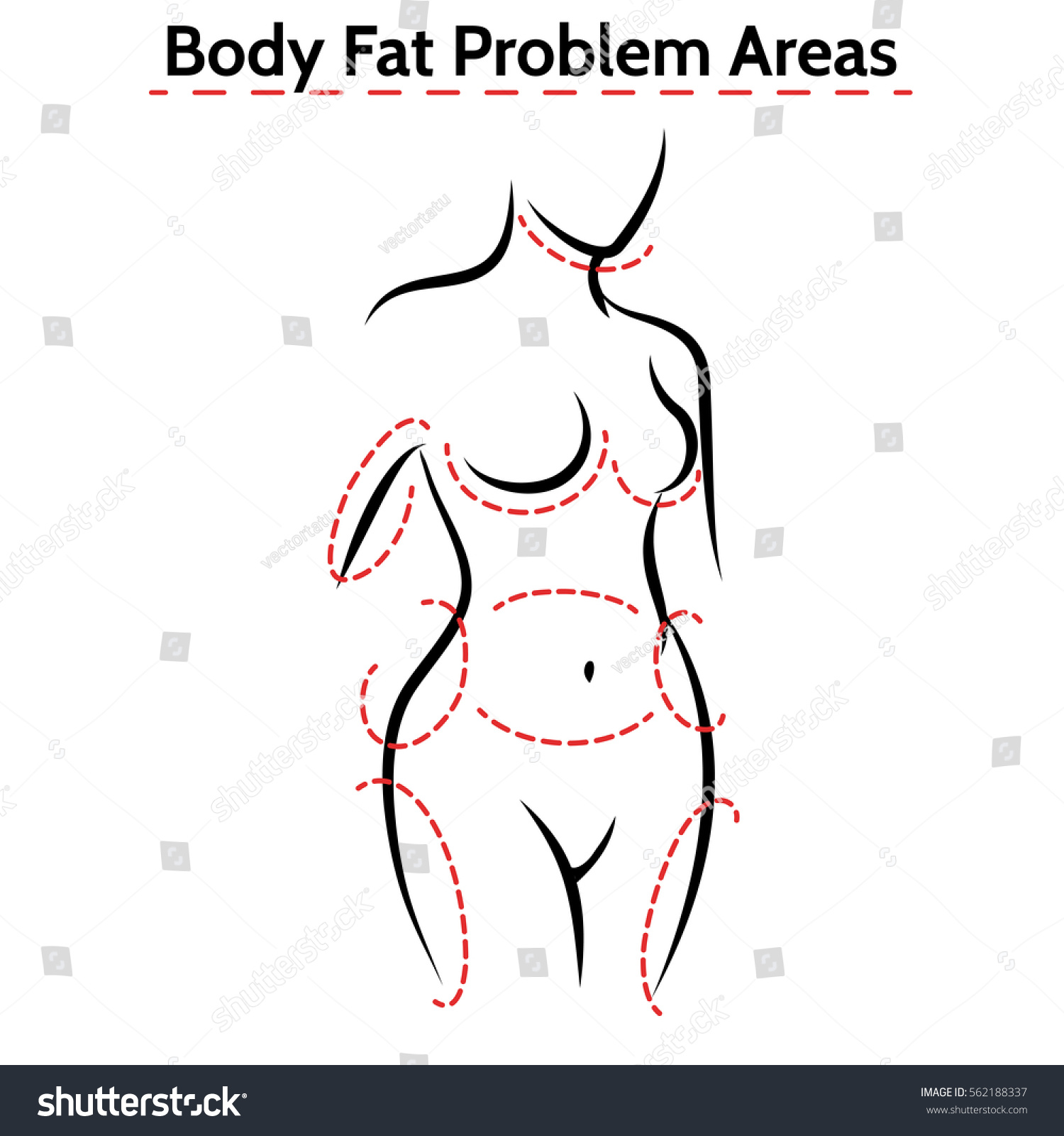 SVG of Female body fat problems areas. Vector medical poster with woman silhouette svg