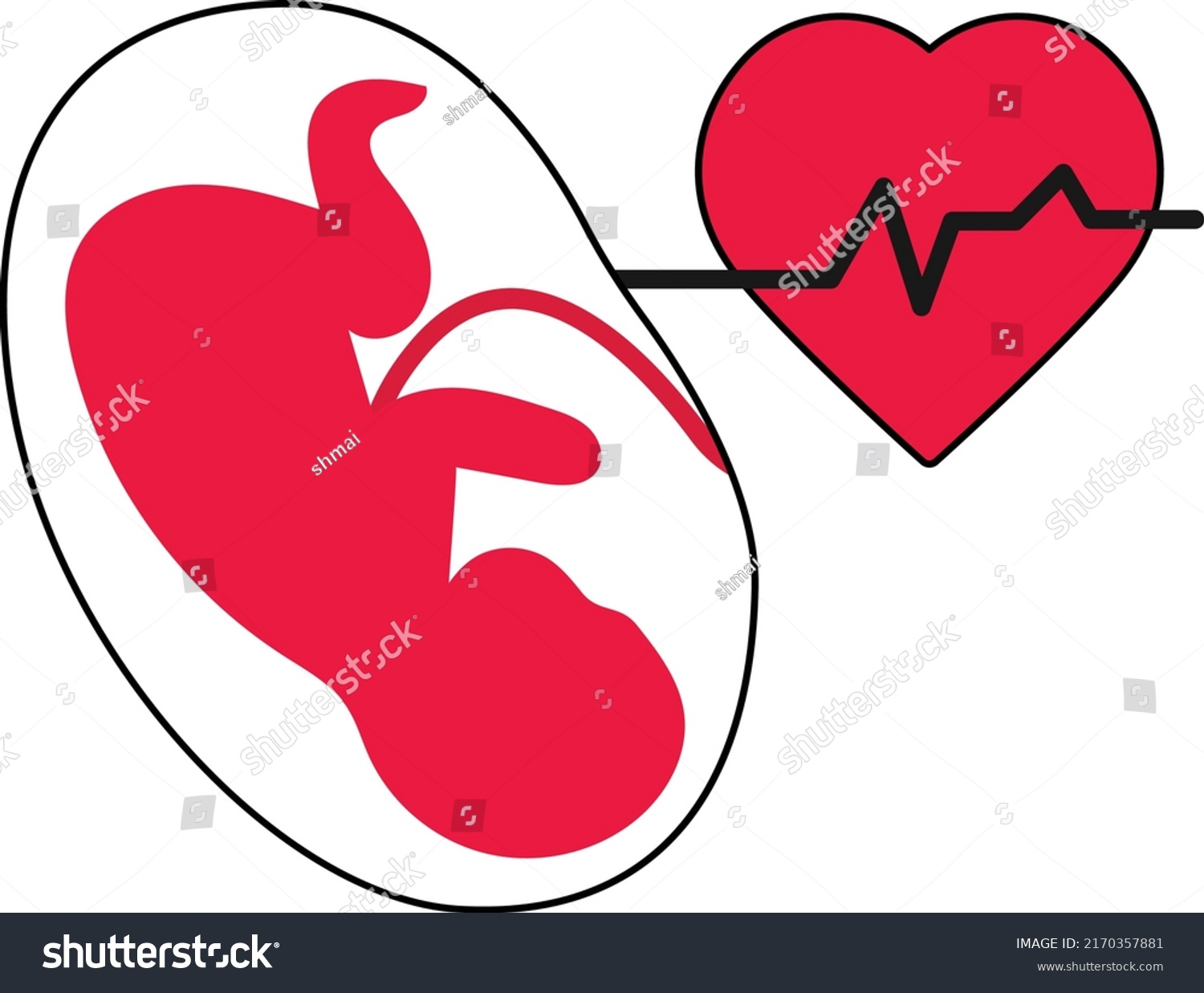 Fetal Heart Monitoring Pregnant Women Ultra Stock Vector (royalty Free 