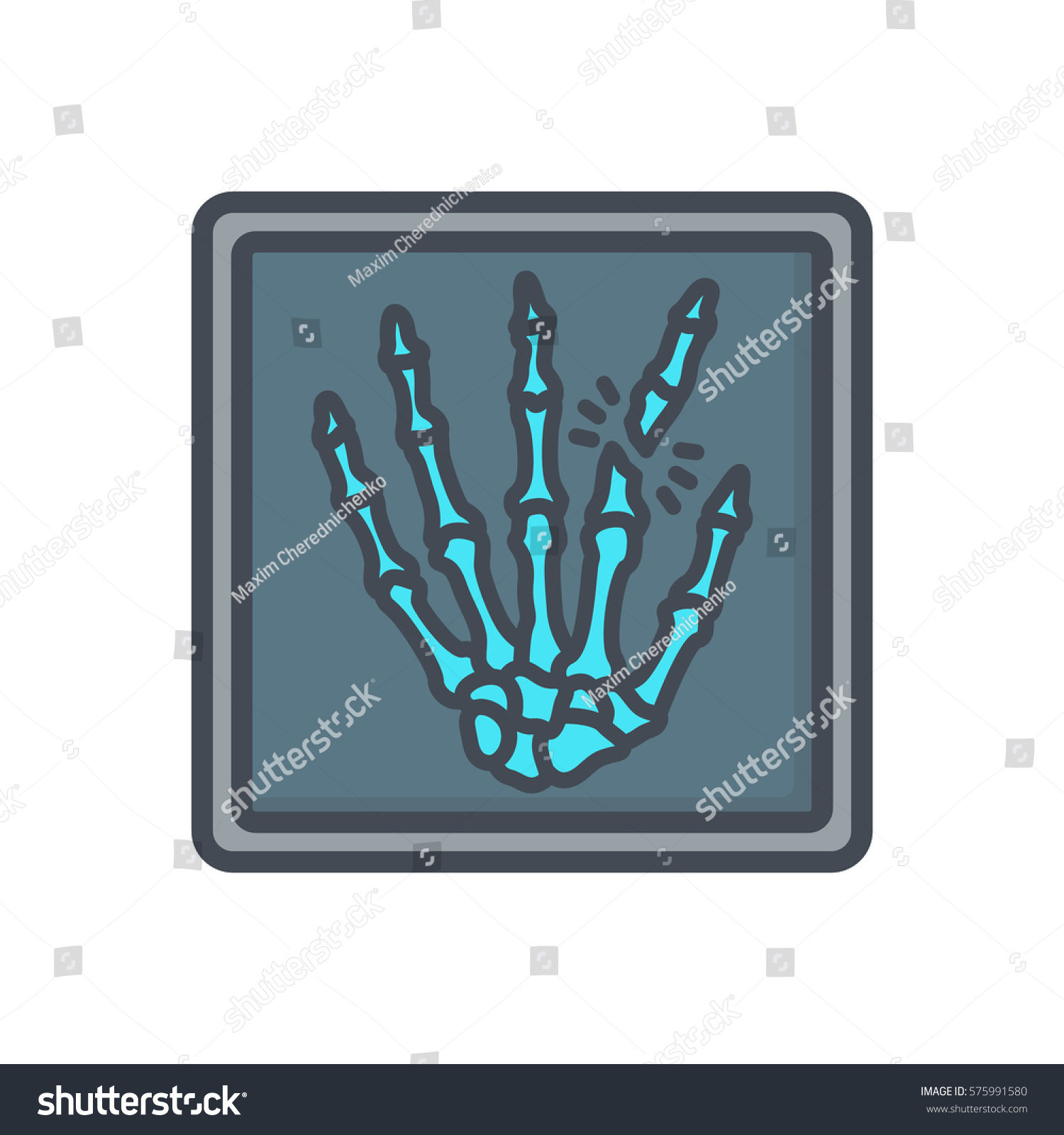 blue hand x-ray with broken bones clip art preview