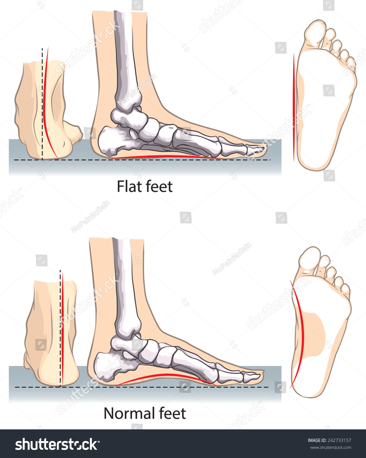 18,485 Human foot anatomy Stock Vectors, Images & Vector Art | Shutterstock