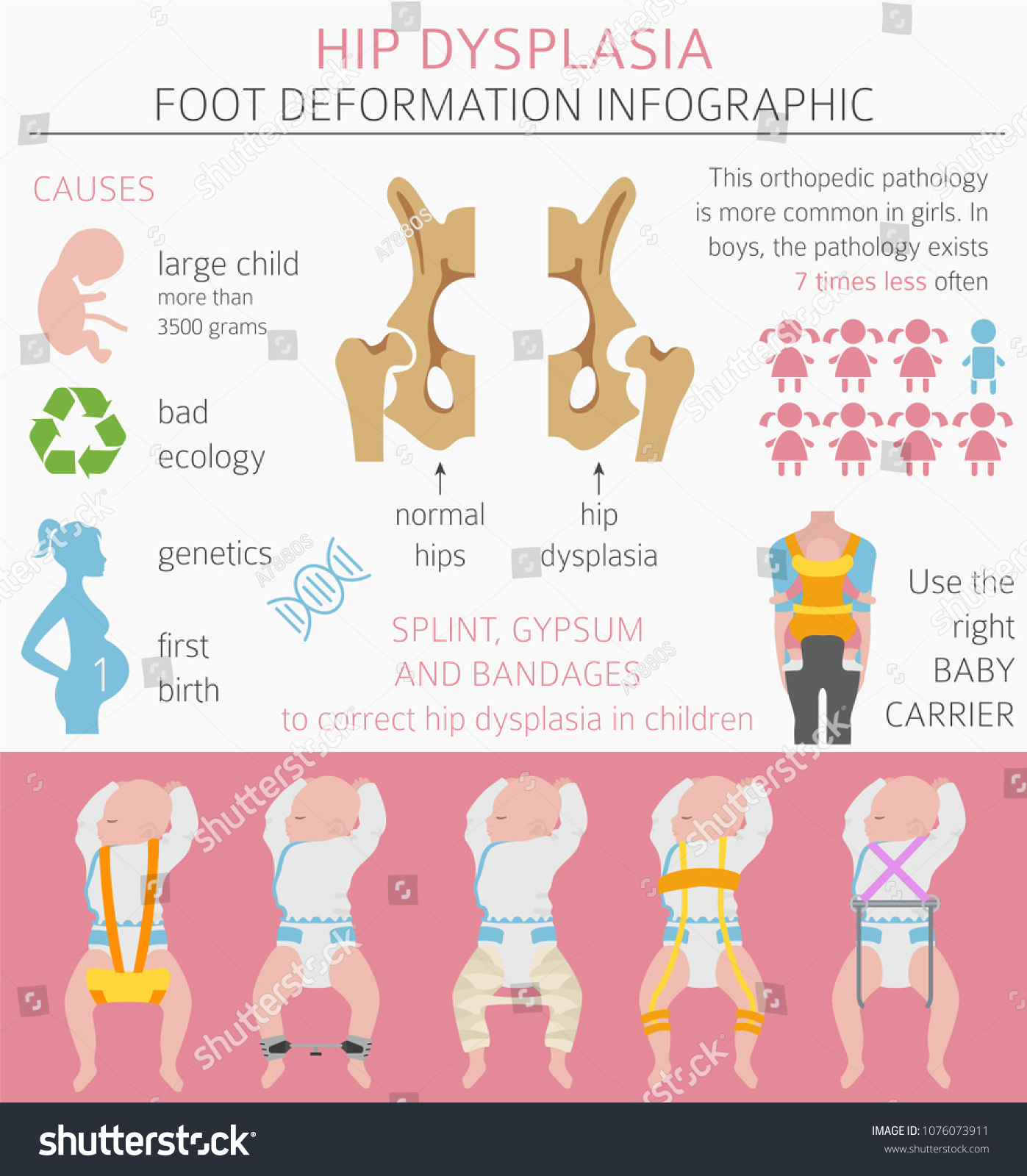 Foot Deformation Types Medical Desease Infographic Stock Vector