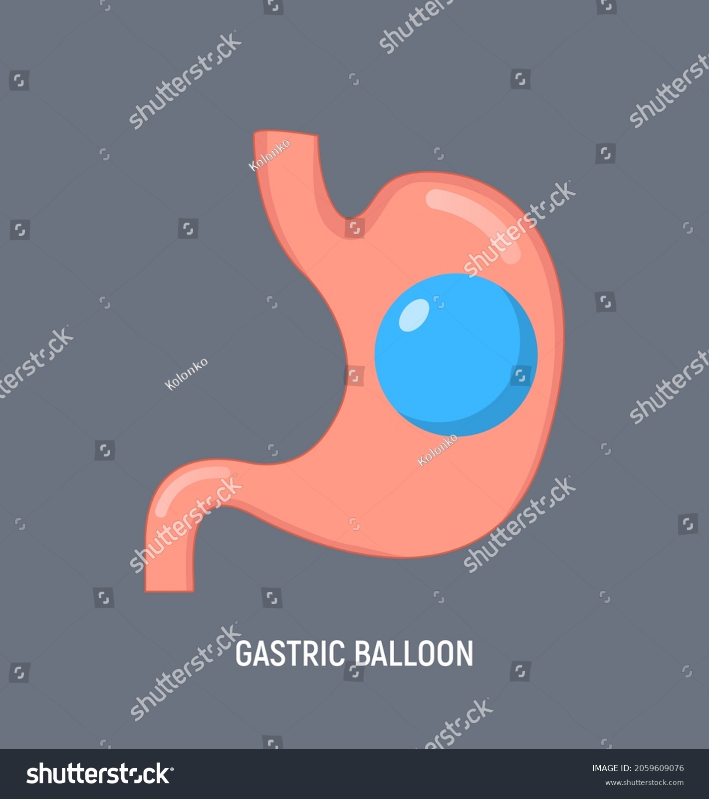 SVG of Gastric balloon weight loss intragastric surgery. Stomach gastric balloon operation vector icon svg