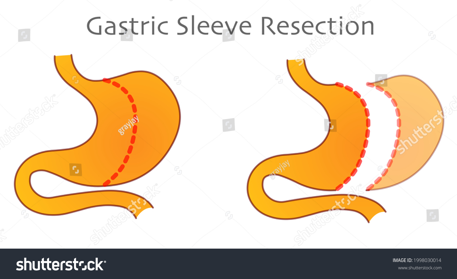 Bypass Stock Vectors, Images & Vector Art | Shutterstock