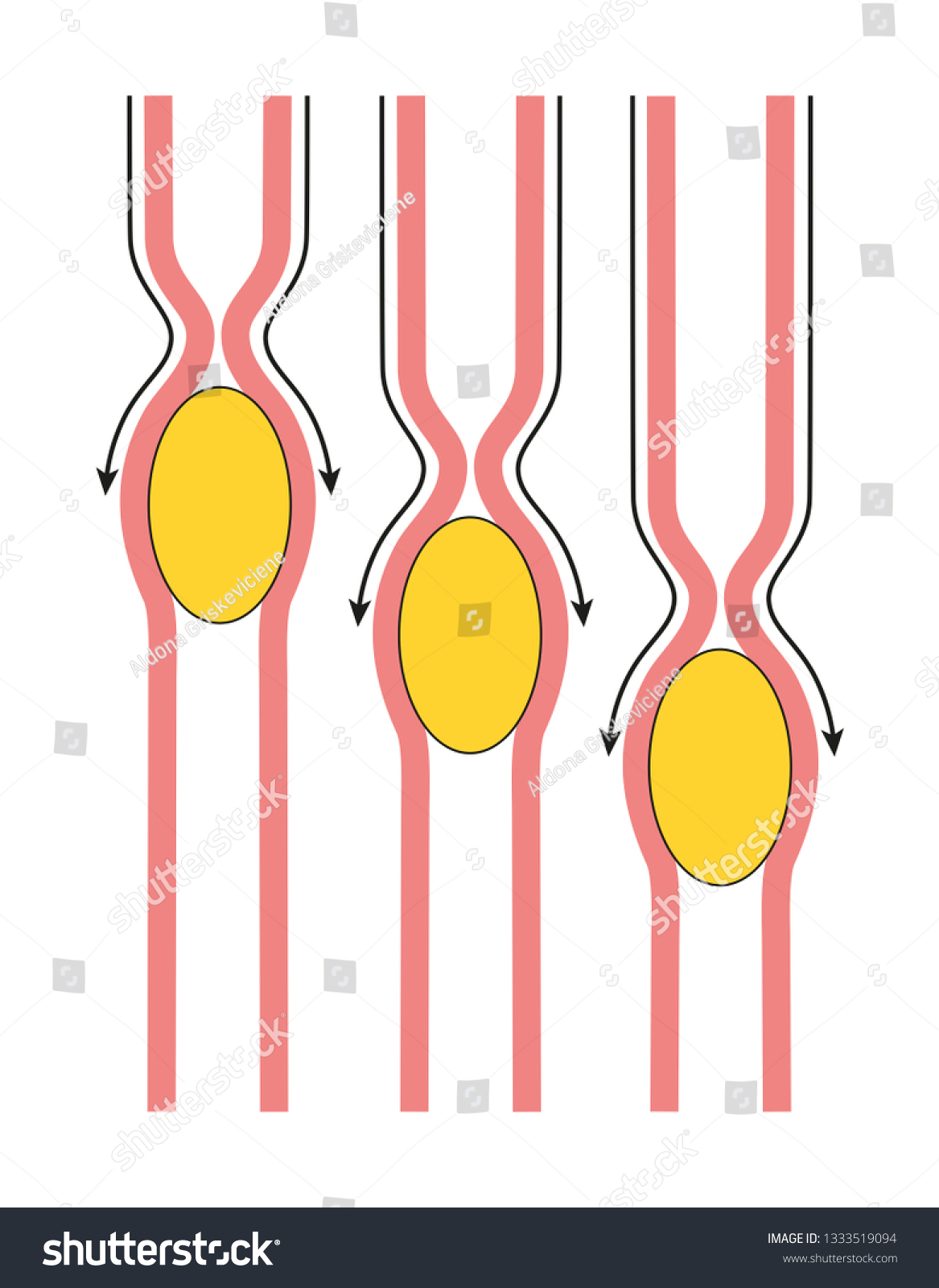 Gastrointestinal Peristalsis Diagram vector de stock (libre de