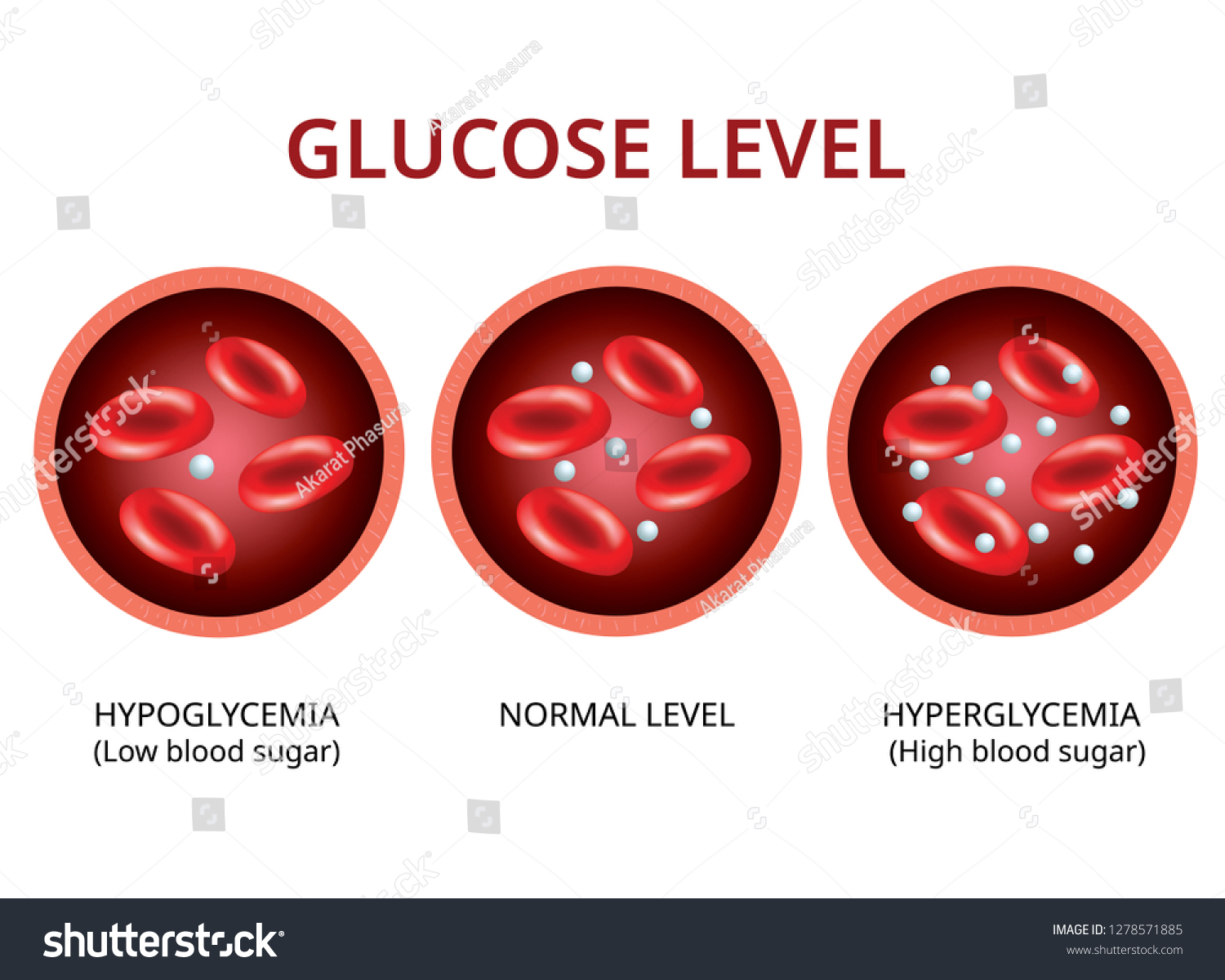 glucose-level-blood-vessel-normal-level-vector-c-s-n-mi-n-ph-b-n