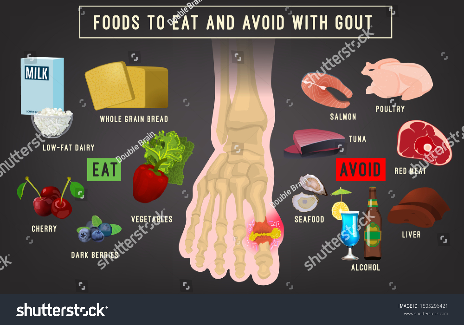 Gout Arthritis Infographic Foods Eat Avoid Stock Vector (Royalty Free ...