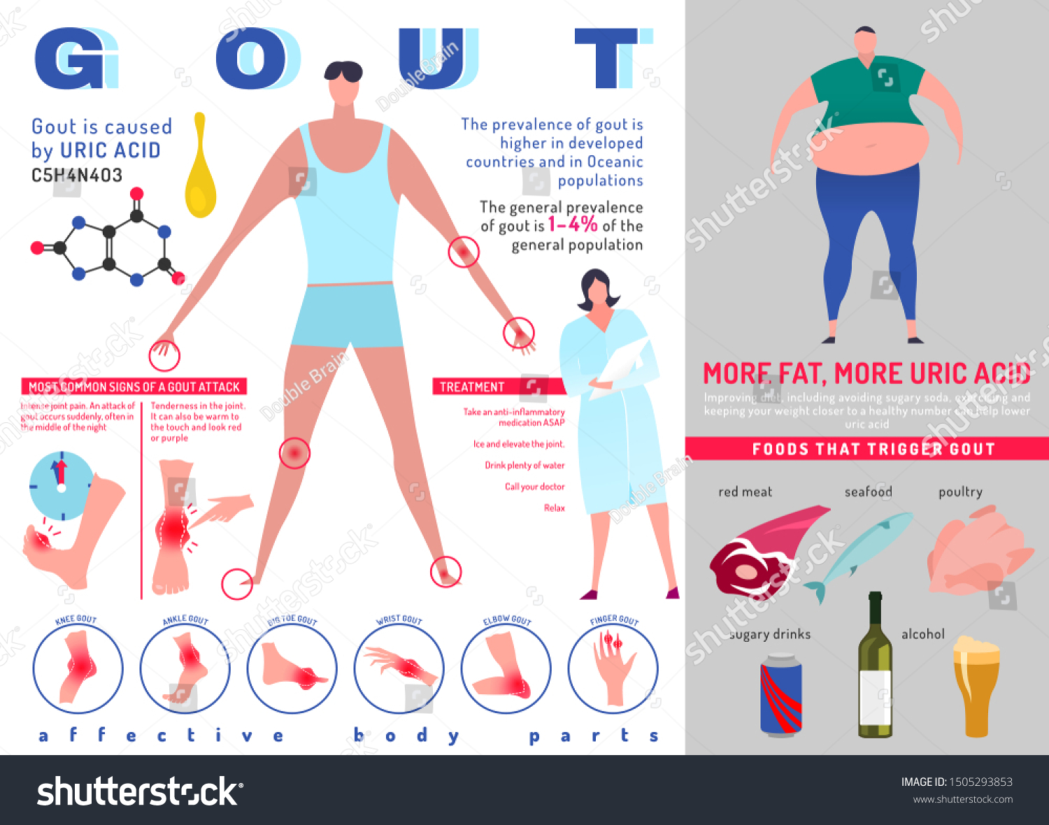 Gout Arthritis Infographic Joint Pain Human Stock Vector (Royalty Free ...