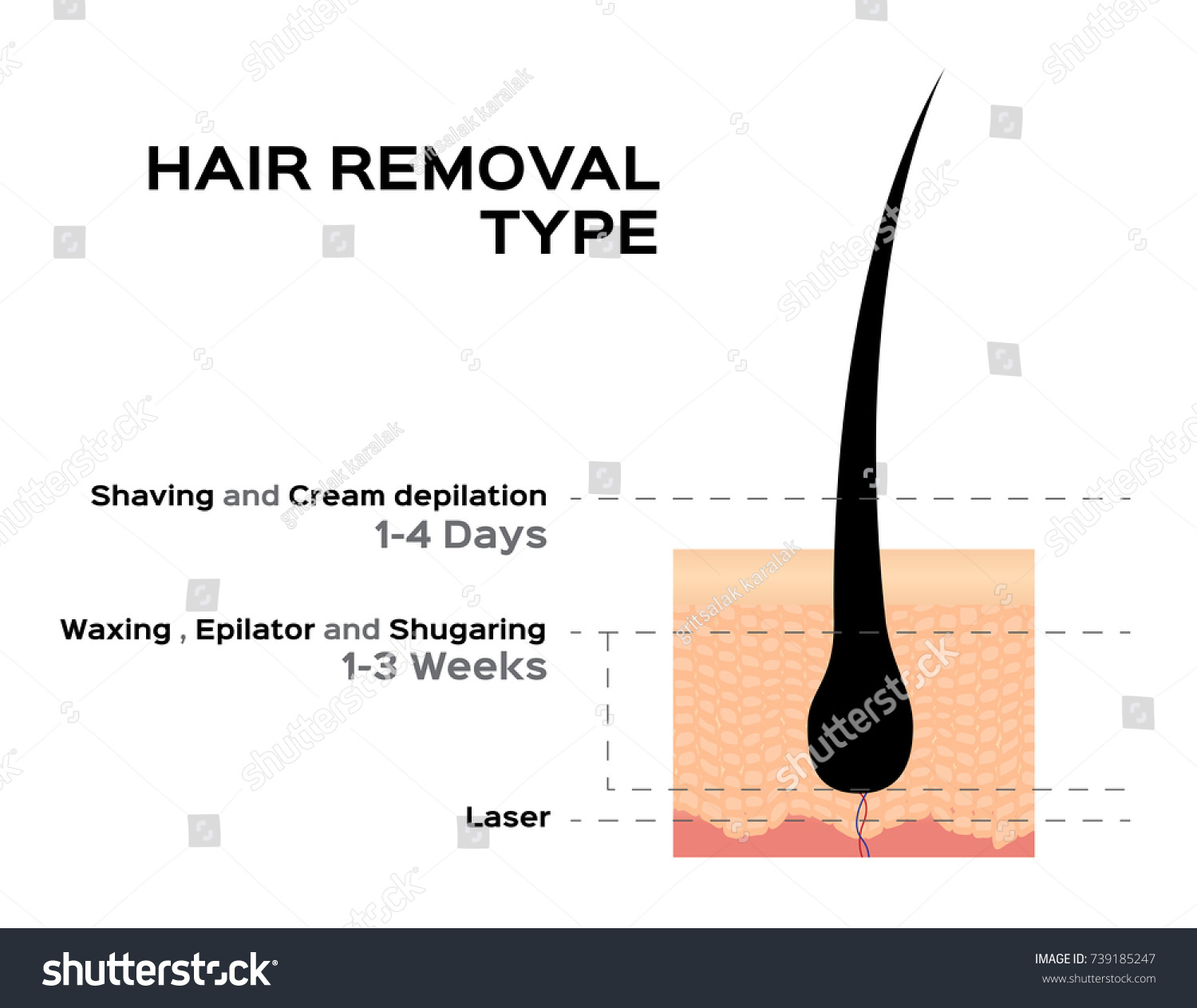 Hair Removal Type Vector Shaving Cream Vector De Stock Libre De Regalías 739185247 