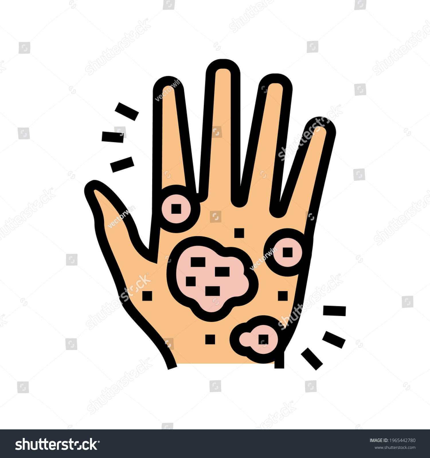 Hand Eczema Color Icon Vector Hand Stock Vector (Royalty Free ...